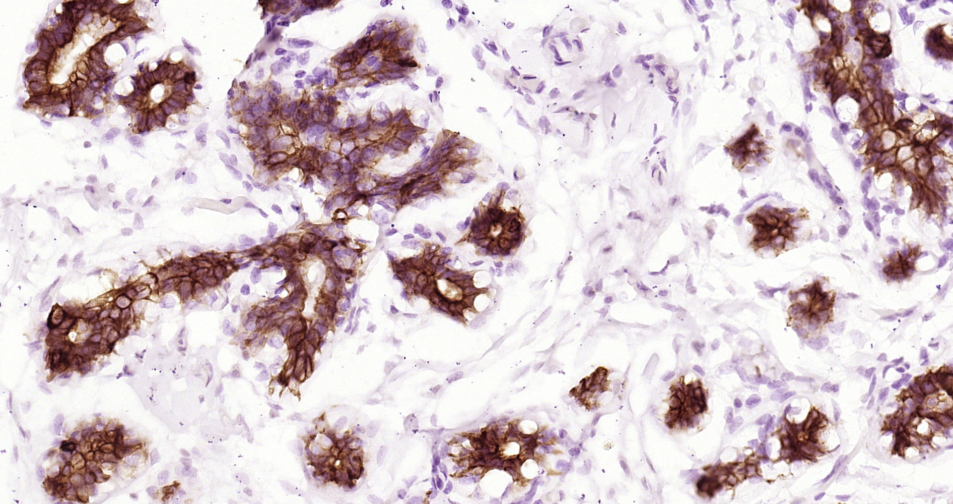 Paraformaldehyde-fixed and paraffin-embedded human breast tissue incubated with GSK3 beta(Ser 9) (7A4) Monoclonal Antibody (bsm-52160R) at 1:200, overnight at 4\u00b0C, followed by a conjugated secondary antibody and DAB staining. Counterstained with hematoxylin.