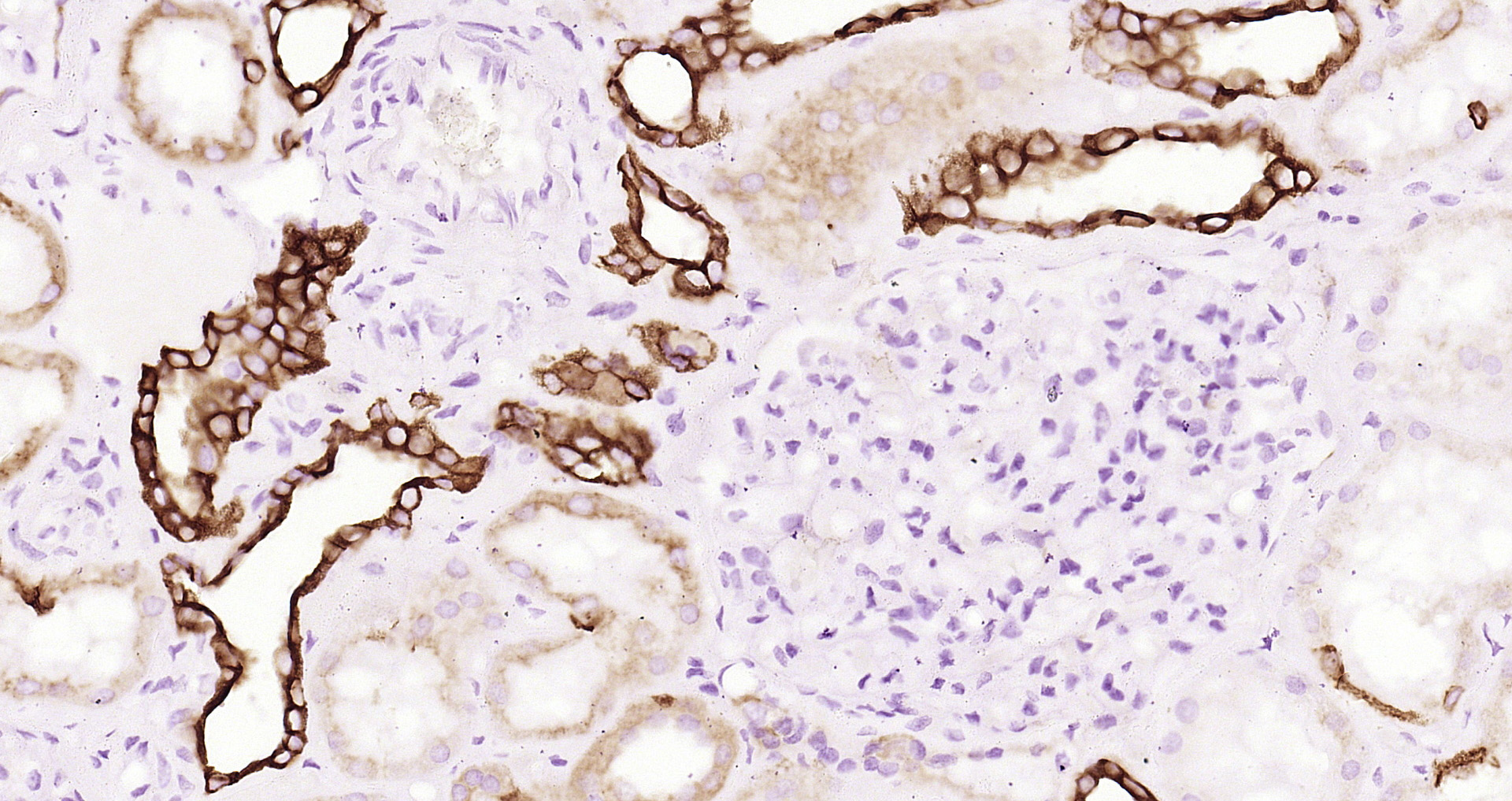 Paraformaldehyde-fixed and paraffin-embedded human kidney tissue incubated with GSK3 beta(Ser 9) (7A4) Monoclonal Antibody (bsm-52160R) at 1:200, overnight at 4\u00b0C, followed by a conjugated secondary antibody and DAB staining. Counterstained with hematoxylin.