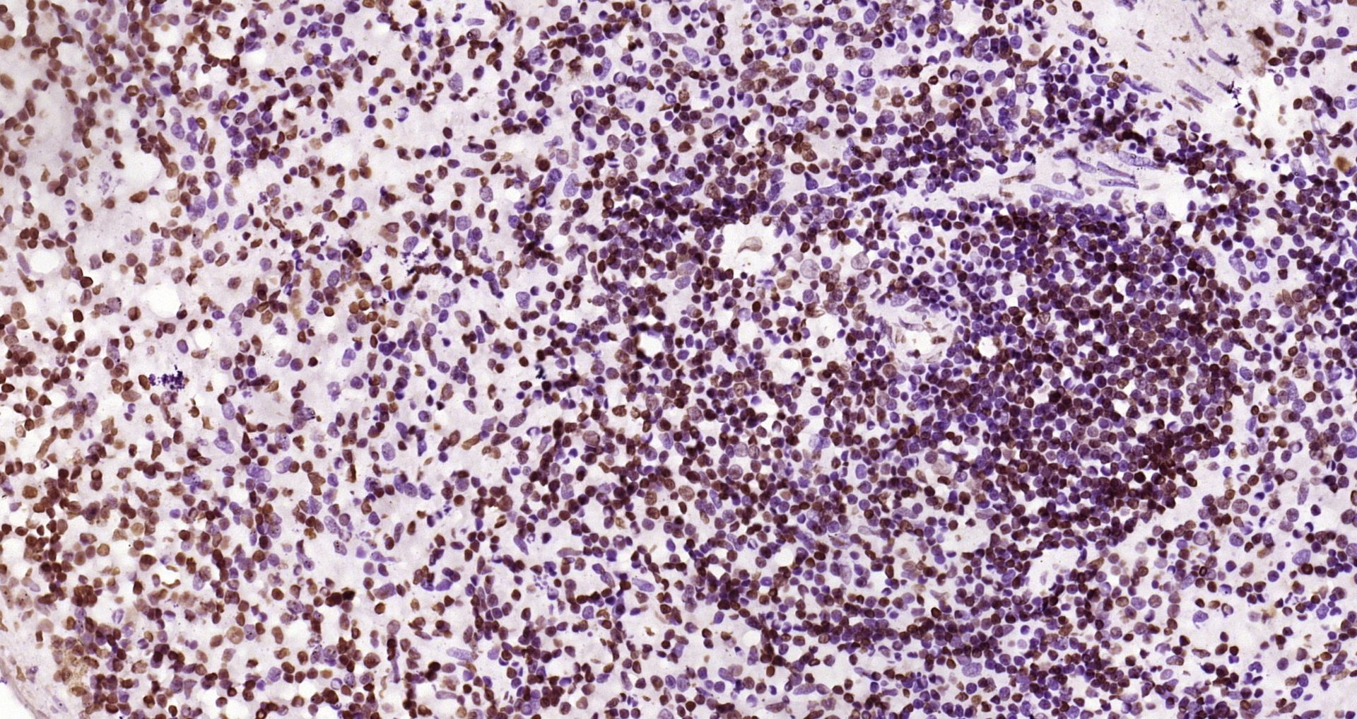 Paraformaldehyde-fixed and paraffin-embedded Mouse spleen tissue incubated with JAK2(Y1007+Y1008) (6E5) Monoclonal Antibody (bsm-52171R) at 1:200, overnight at 4\u00b0C, followed by a conjugated secondary antibody and DAB staining. Counterstained with hematoxylin.