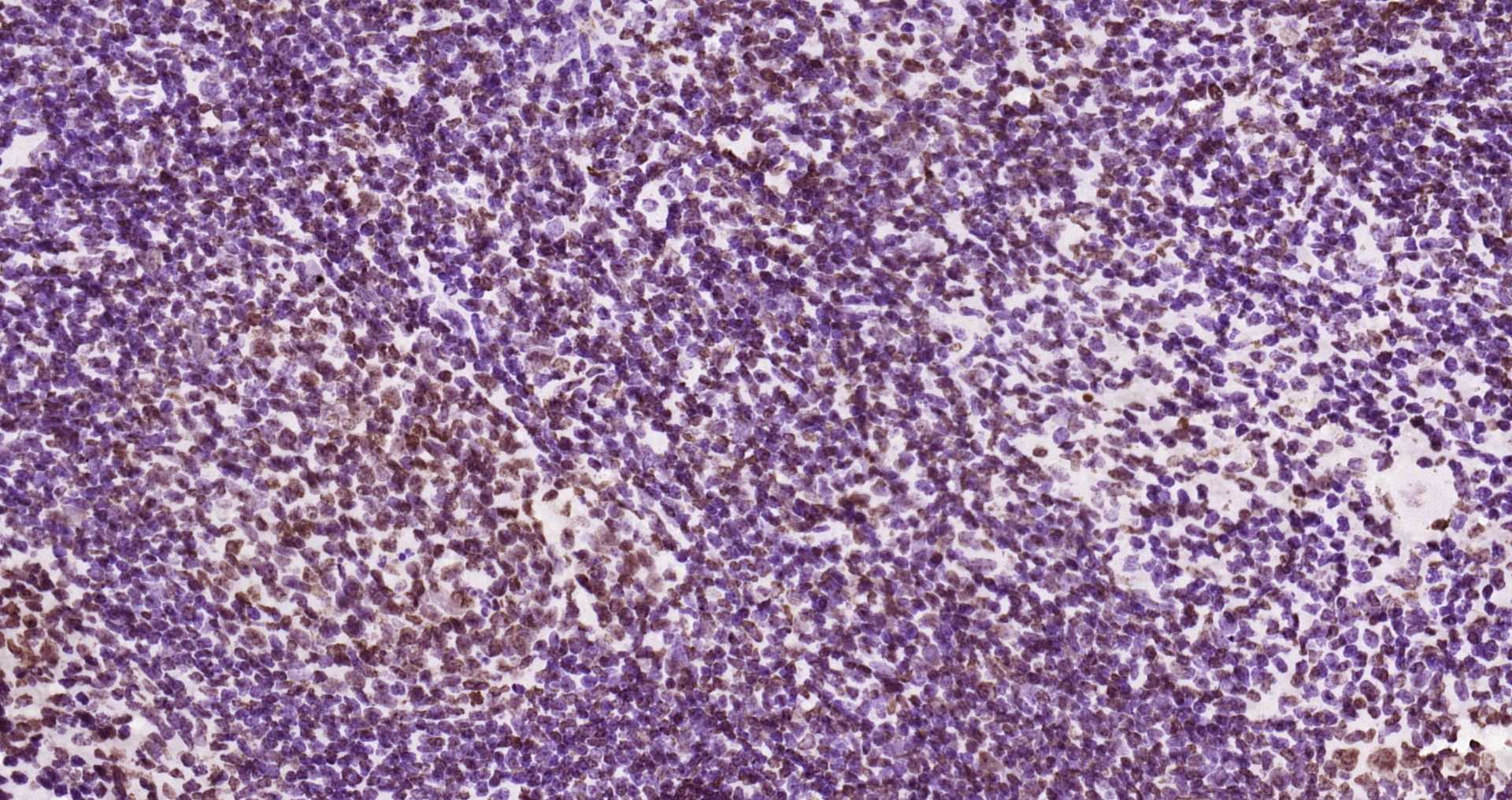 Paraformaldehyde-fixed and paraffin-embedded Rat spleen tissue incubated with JAK2(Y1007+Y1008) (6E5) Monoclonal Antibody (bsm-52171R) at 1:200, overnight at 4\u00b0C, followed by a conjugated secondary antibody and DAB staining. Counterstained with hematoxylin.