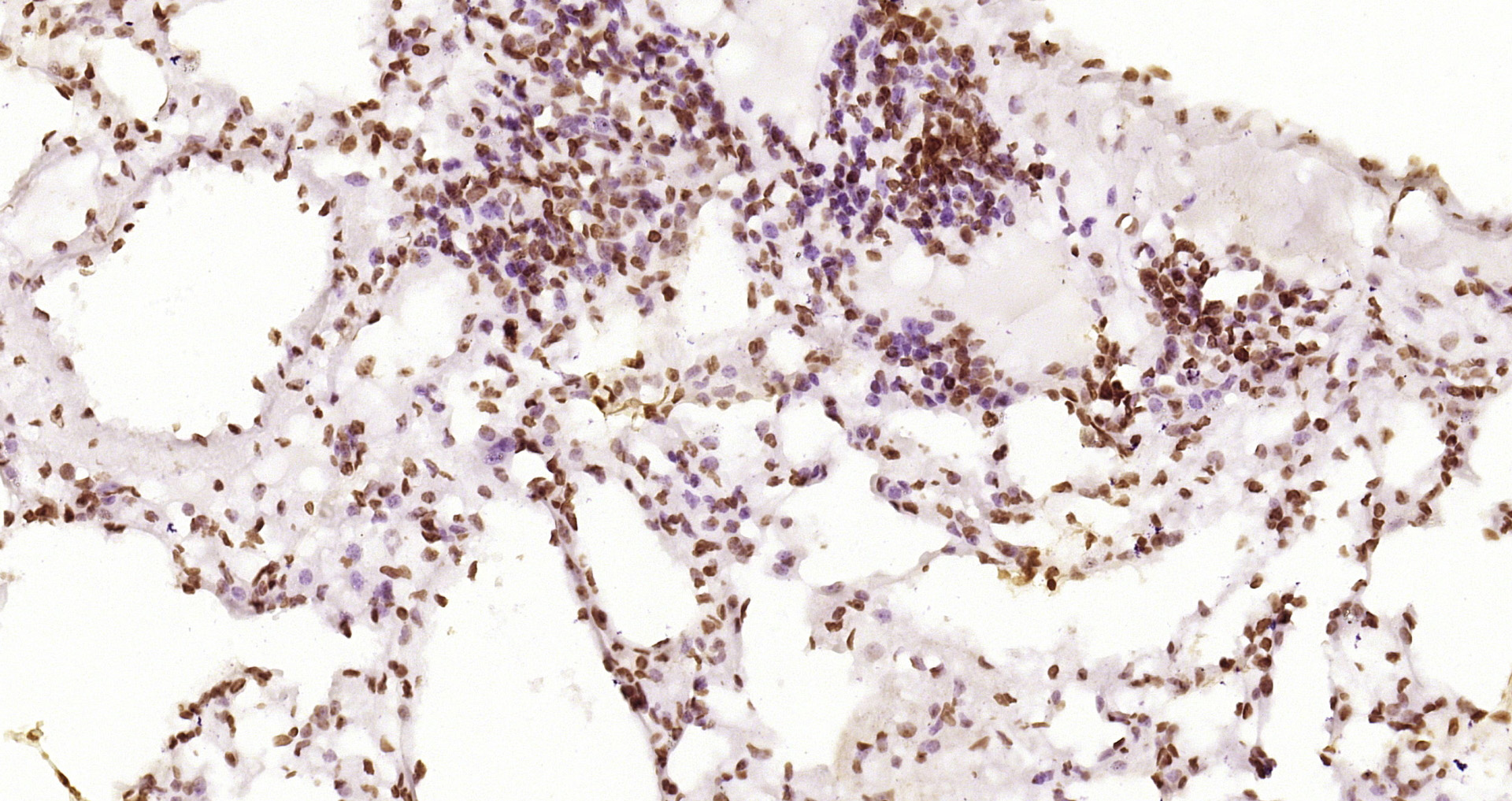 Paraformaldehyde-fixed and paraffin-embedded Rat lung tissue incubated with JAK2(Y1007+Y1008) (6E5) Monoclonal Antibody (bsm-52171R) at 1:200, overnight at 4\u00b0C, followed by a conjugated secondary antibody and DAB staining. Counterstained with hematoxylin.