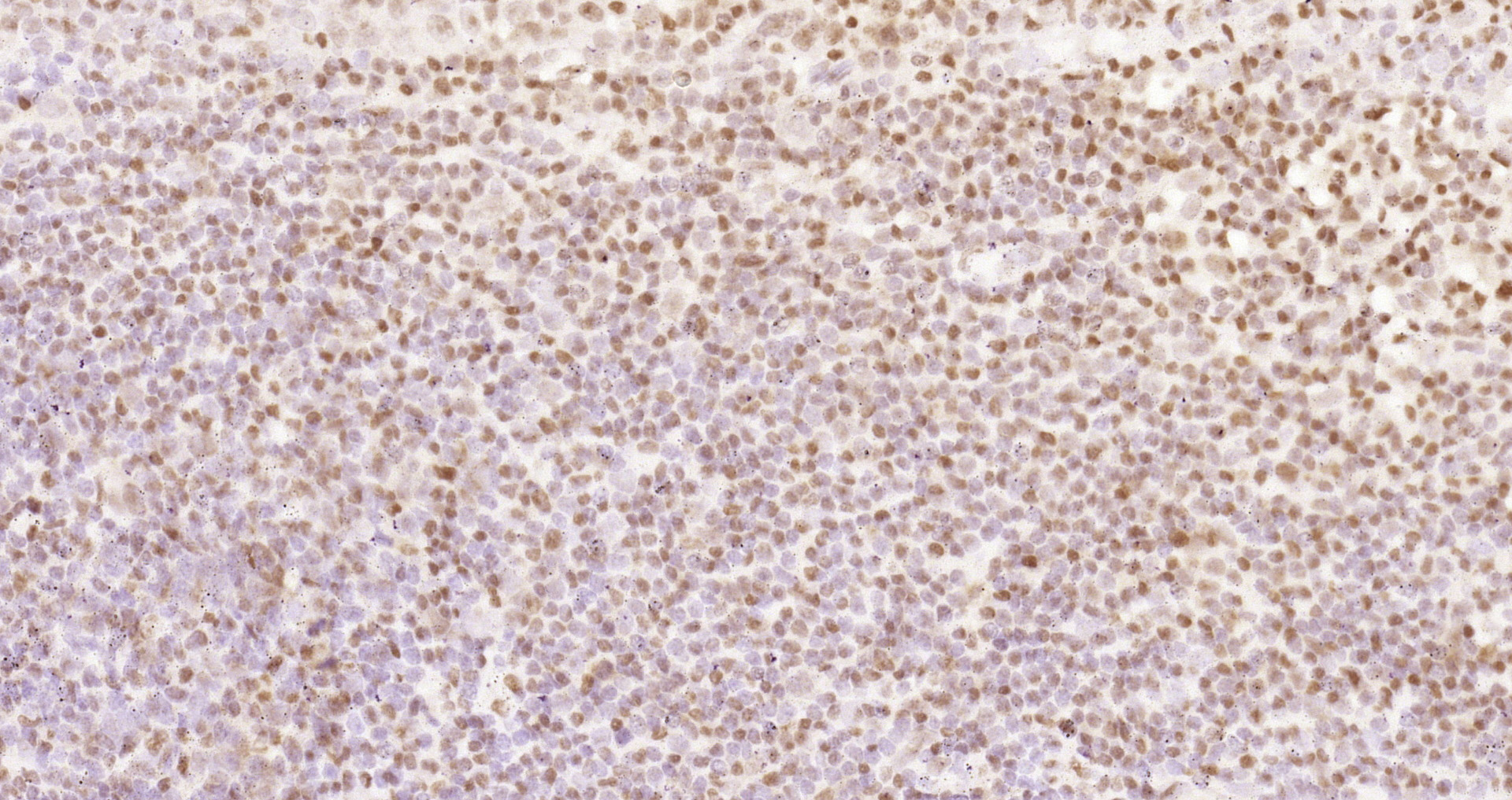 Paraformaldehyde-fixed and paraffin-embedded Human tonsil tissue incubated with Nrf2(S40) (7G4) Monoclonal Antibody (bsm-52179R) at 1:200, overnight at 4\u00b0C, followed by a conjugated secondary antibody and DAB staining. Counterstained with hematoxylin.