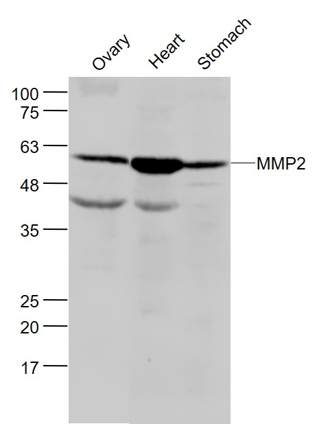 Lane 1: Mouse Ovary lysates; Lane 2: Mouse Heart lysates; Lane 3: Mouse Stomach lysates probed with MMP2 Polyclonal Antibody, Unconjugated (bs-0412R) at 1:300 dilution and 4˚C overnight incubation. Followed by conjugated secondary antibody incubation at 1:20000 for 60 min at 37˚C.