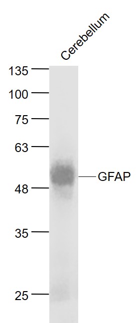Mouse Cerebellum lysates probed with GFAP Monoclonal Antibody, Unconjugated (bsm-33065M) at 1:1000 dilution and 4˚C overnight incubation. Followed by conjugated secondary antibody incubation at 1:20000 for 60 min at 37˚C.