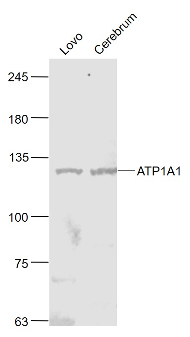 Lane 1: Lovo cell lysates; Lane 2: Mouse Cerebrum lysates probed with ATP1A1 Polyclonal Antibody, Unconjugated (bs-4255R) at 1:1000 dilution and 4˚C overnight incubation. Followed by conjugated secondary antibody incubation at 1:20000 for 60 min at 37˚C.