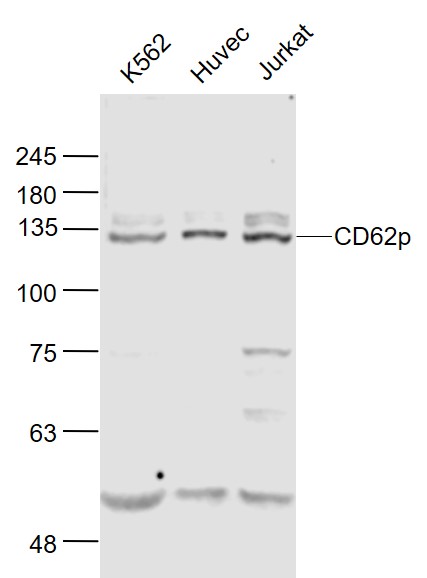 Lane 1: K562 cell lysates; Lane 2: Huvec cell lysates; Lane 3: Jurkat cell lysates probed with CD62p Polyclonal Antibody, Unconjugated (bs-0561R) at 1:1000 dilution and 4˚C overnight incubation. Followed by conjugated secondary antibody incubation at 1:20000 for 60 min at 37˚C.