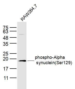 Lane 1: RAW264.7 (Mouse) Cell Lysate probed with Alpha-synuclein(Ser129) Antibody, Unconjugated (bs-5628R) at 1:300 dilution and 4˚C overnight incubation. Followed by conjugated secondary antibody incubation at 1:20000 for 60 min at 37˚C.