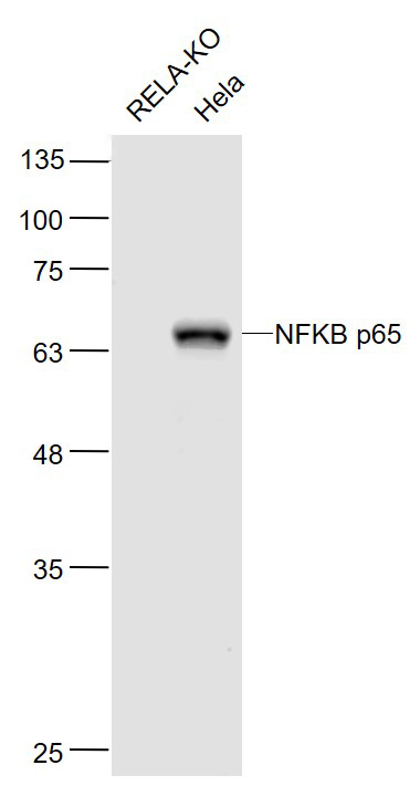 Lane 1: Rela-KO cell lysates; Lane 2: Hela cell lysates probed with NFKB p65 (7G6) Monoclonal Antibody, Unconjugated (bsm-33117M) at 1:1000 dilution and 4˚C overnight incubation. Followed by conjugated secondary antibody incubation at 1:20000 for 60 min at 37˚C.