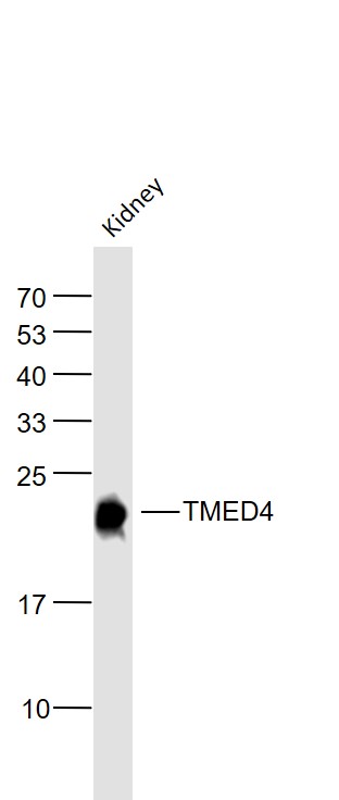 Lane 1: Mouse Kidney lysates probed with TMED4 Polyclonal Antibody, Unconjugated (bs-6208R) at 1:1000 dilution and 4˚C overnight incubation. Followed by conjugated secondary antibody incubation at 1:20000 for 60 min at 37˚C.