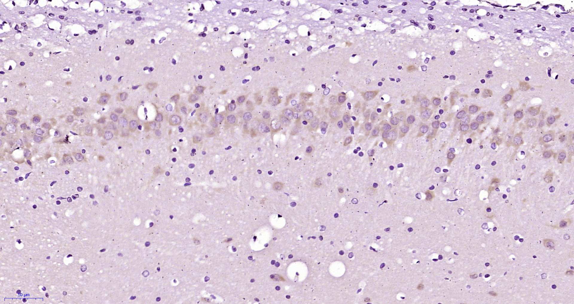 Paraformaldehyde-fixed, paraffin embedded Rat brain; Antigen retrieval by boiling in sodium citrate buffer (pH6.0) for 15min; Block endogenous peroxidase by 3% hydrogen peroxide for 20 minutes; Blocking buffer (normal goat serum) at 37°C for 30min; Antibody incubation with FOX3/NeuN Polyclonal Antibody, Unconjugated (bs-1613R) at 1:200 overnight at 4°C, DAB staining.