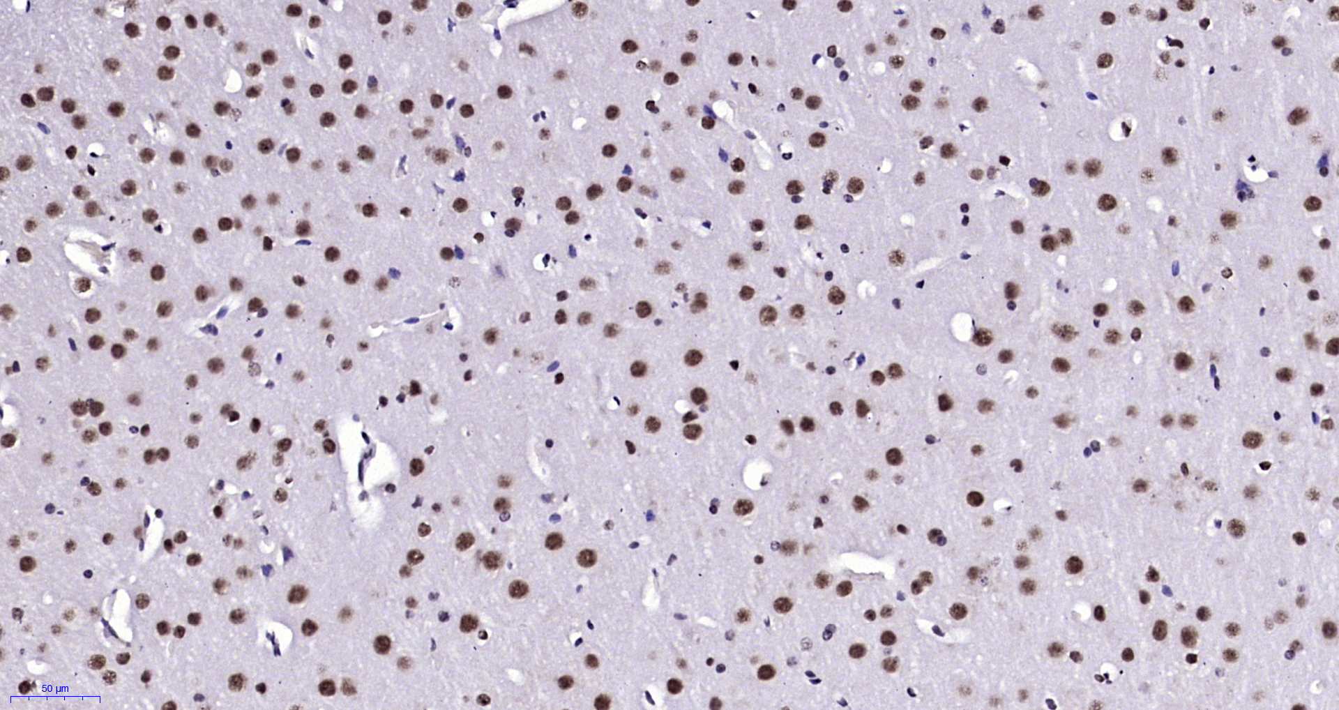 Paraformaldehyde-fixed, paraffin embedded Mouse brain; Antigen retrieval by boiling in sodium citrate buffer (pH6.0) for 15min; Block endogenous peroxidase by 3% hydrogen peroxide for 20 minutes; Blocking buffer (normal goat serum) at 37°C for 30min; Antibody incubation with Notch3/4 Polyclonal Antibody, Unconjugated (bs-1812R) at 1:200 overnight at 4°C, DAB staining.