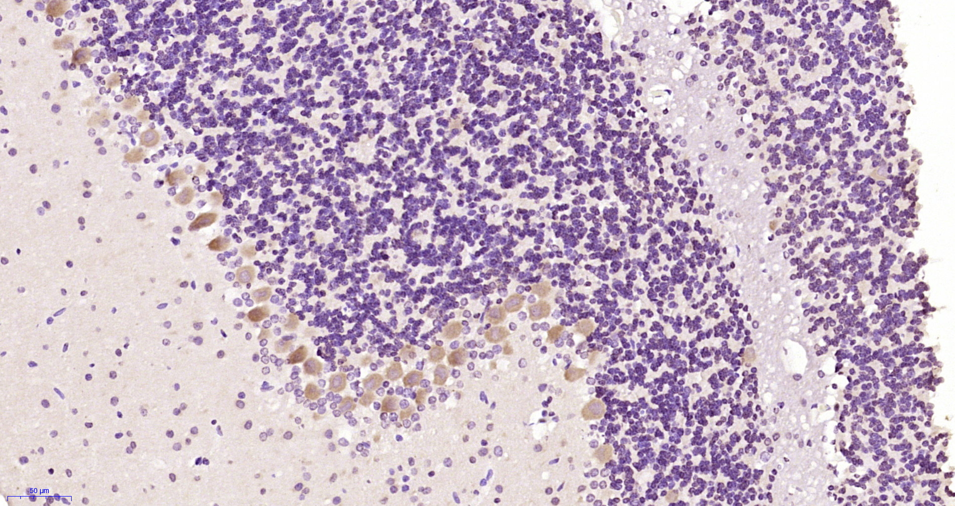 Paraformaldehyde-fixed, paraffin embedded Rat cerebellum; Antigen retrieval by boiling in sodium citrate buffer (pH6.0) for 15min; Block endogenous peroxidase by 3% hydrogen peroxide for 20 minutes; Blocking buffer (normal goat serum) at 37°C for 30min; Antibody incubation with Bcr Polyclonal Antibody, Unconjugated (bs-2747R) at 1:200 overnight at 4°C, DAB staining.