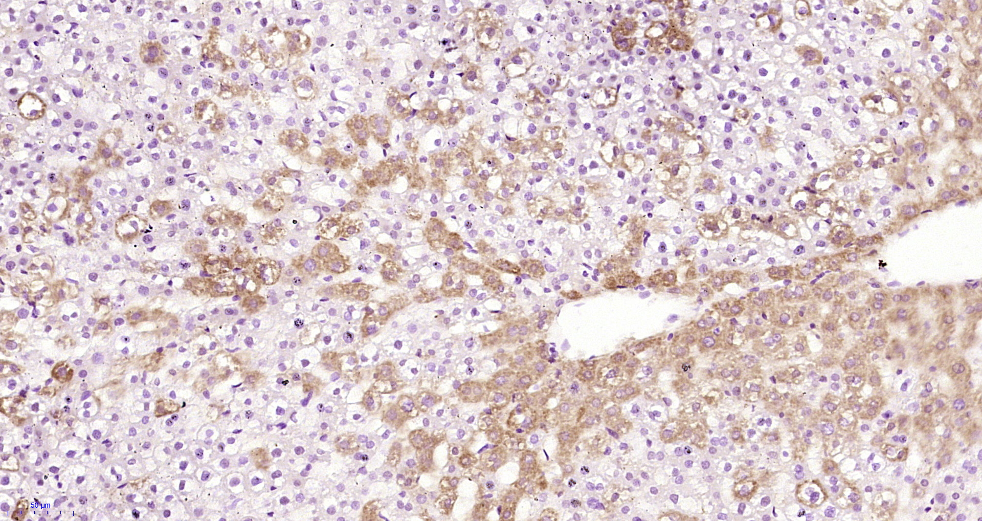Paraformaldehyde-fixed, paraffin embedded Rat liver; Antigen retrieval by boiling in sodium citrate buffer (pH6.0) for 15min; Block endogenous peroxidase by 3% hydrogen peroxide for 20 minutes; Blocking buffer (normal goat serum) at 37°C for 30min; Antibody incubation with Alpha 2 antiplasmin Polyclonal Antibody, Unconjugated (bs-6188R) at 1:200 overnight at 4°C, DAB staining.