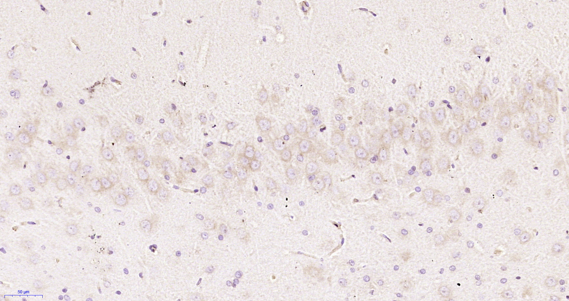 Paraformaldehyde-fixed, paraffin embedded Rat brain; Antigen retrieval by boiling in sodium citrate buffer (pH6.0) for 15min; Block endogenous peroxidase by 3% hydrogen peroxide for 20 minutes; Blocking buffer (normal goat serum) at 37°C for 30min; Antibody incubation with CKAP4 Polyclonal Antibody, Unconjugated (bs-6520R) at 1:200 overnight at 4°C, DAB staining.