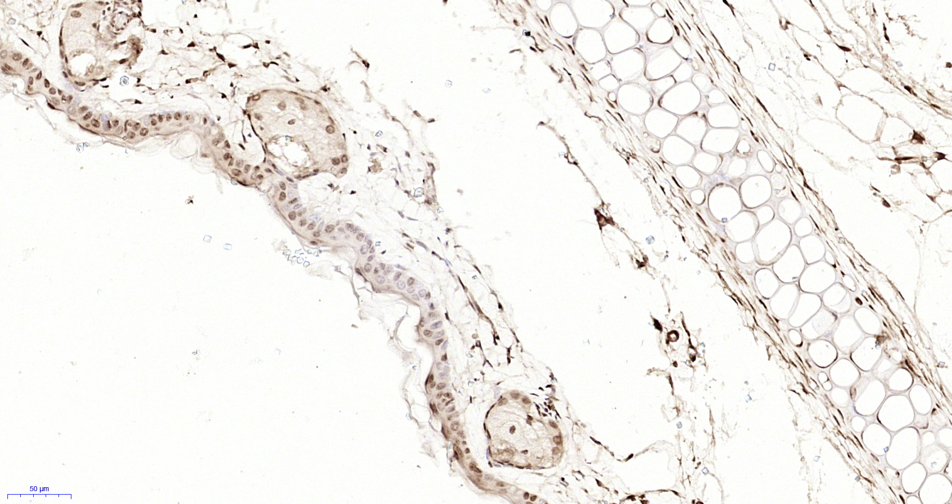 Paraformaldehyde-fixed, paraffin embedded Mouse skin; Antigen retrieval by boiling in sodium citrate buffer (pH6.0) for 15min; Block endogenous peroxidase by 3% hydrogen peroxide for 20 minutes; Blocking buffer (normal goat serum) at 37°C for 30min; Antibody incubation with Alpha 2 antiplasmin Polyclonal Antibody, Unconjugated (bs-8212R) at 1:200 overnight at 4°C, DAB staining.