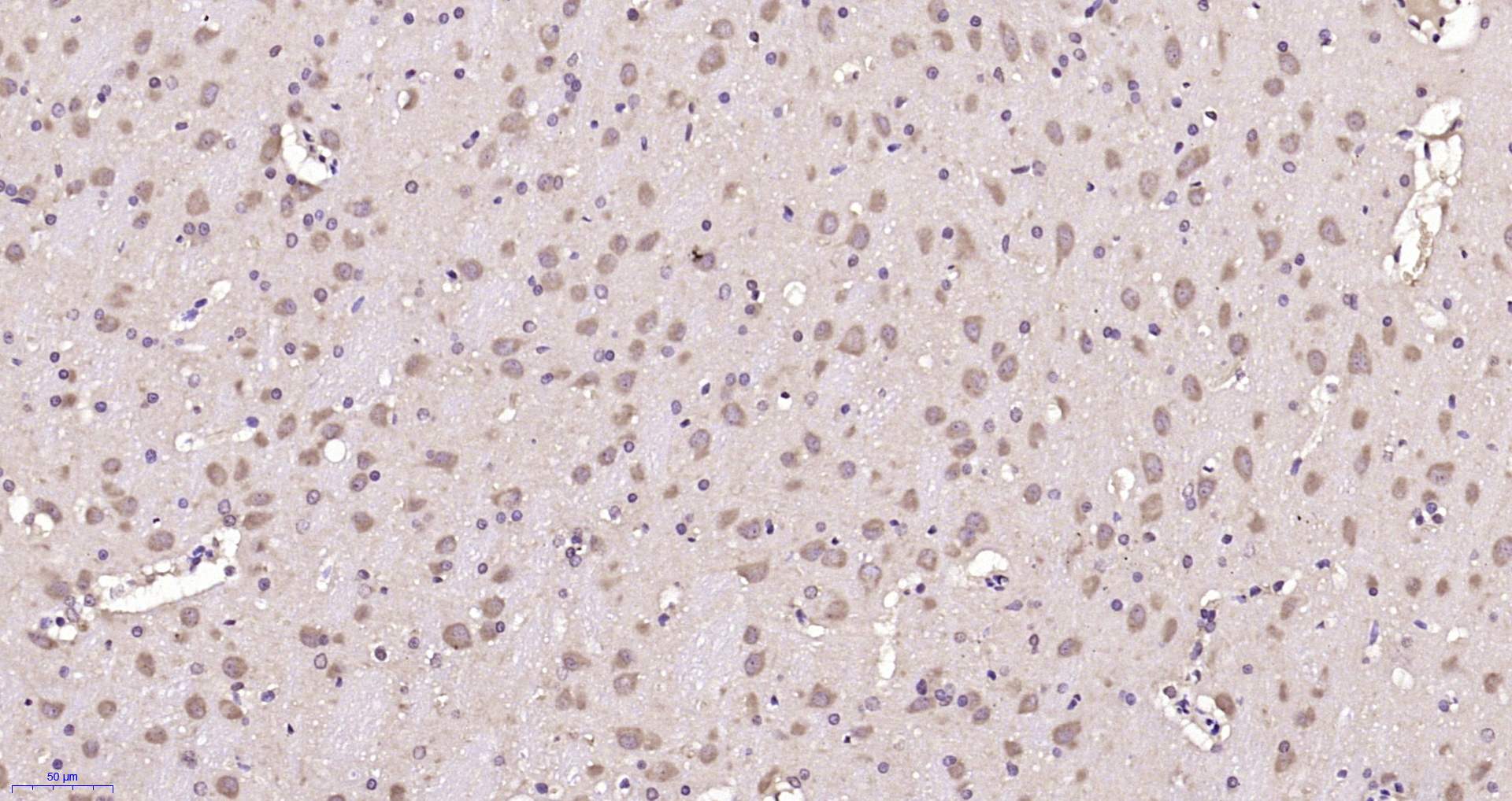 Paraformaldehyde-fixed, paraffin embedded Rat brain; Antigen retrieval by boiling in sodium citrate buffer (pH6.0) for 15min; Block endogenous peroxidase by 3% hydrogen peroxide for 20 minutes; Blocking buffer (normal goat serum) at 37°C for 30min; Antibody incubation with GPRIN3 Polyclonal Antibody, Unconjugated (bs-8277R) at 1:200 overnight at 4°C, DAB staining.