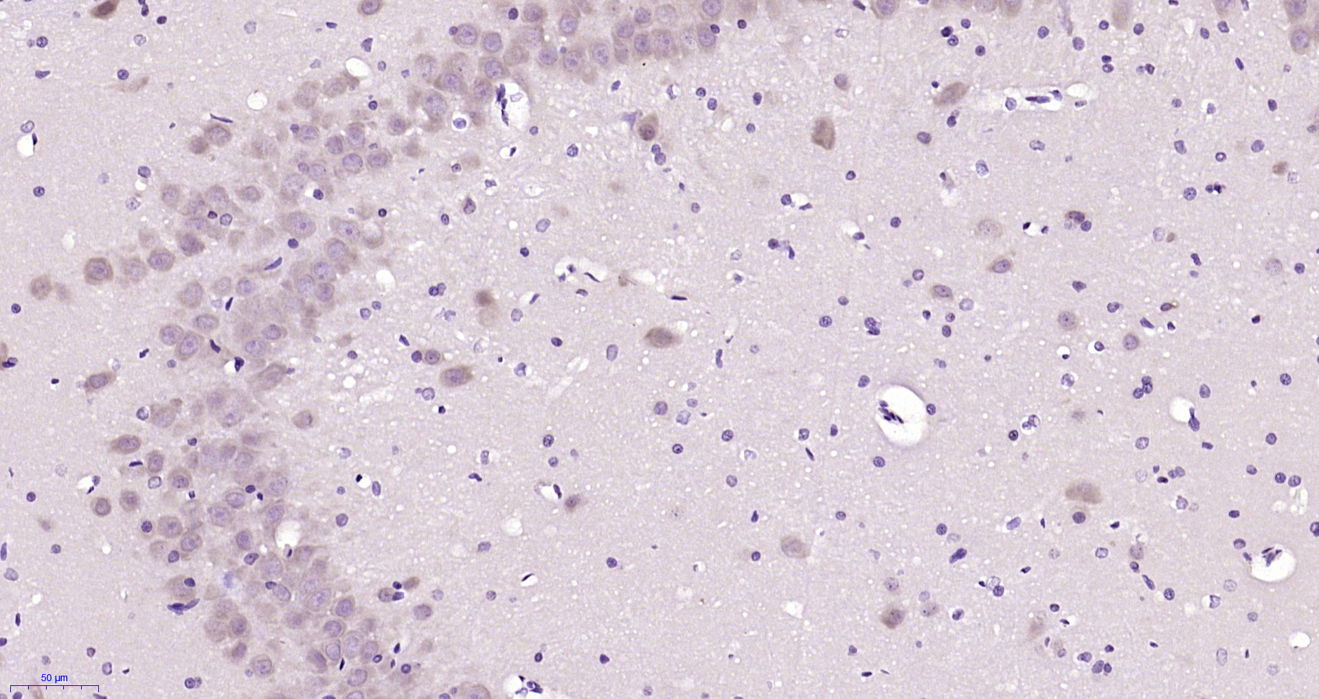 Paraformaldehyde-fixed, paraffin embedded Rat brain; Antigen retrieval by boiling in sodium citrate buffer (pH6.0) for 15min; Block endogenous peroxidase by 3% hydrogen peroxide for 20 minutes; Blocking buffer (normal goat serum) at 37°C for 30min; Antibody incubation with PAFAHG Polyclonal Antibody, Unconjugated (bs-9901R) at 1:200 overnight at 4°C, DAB staining.
