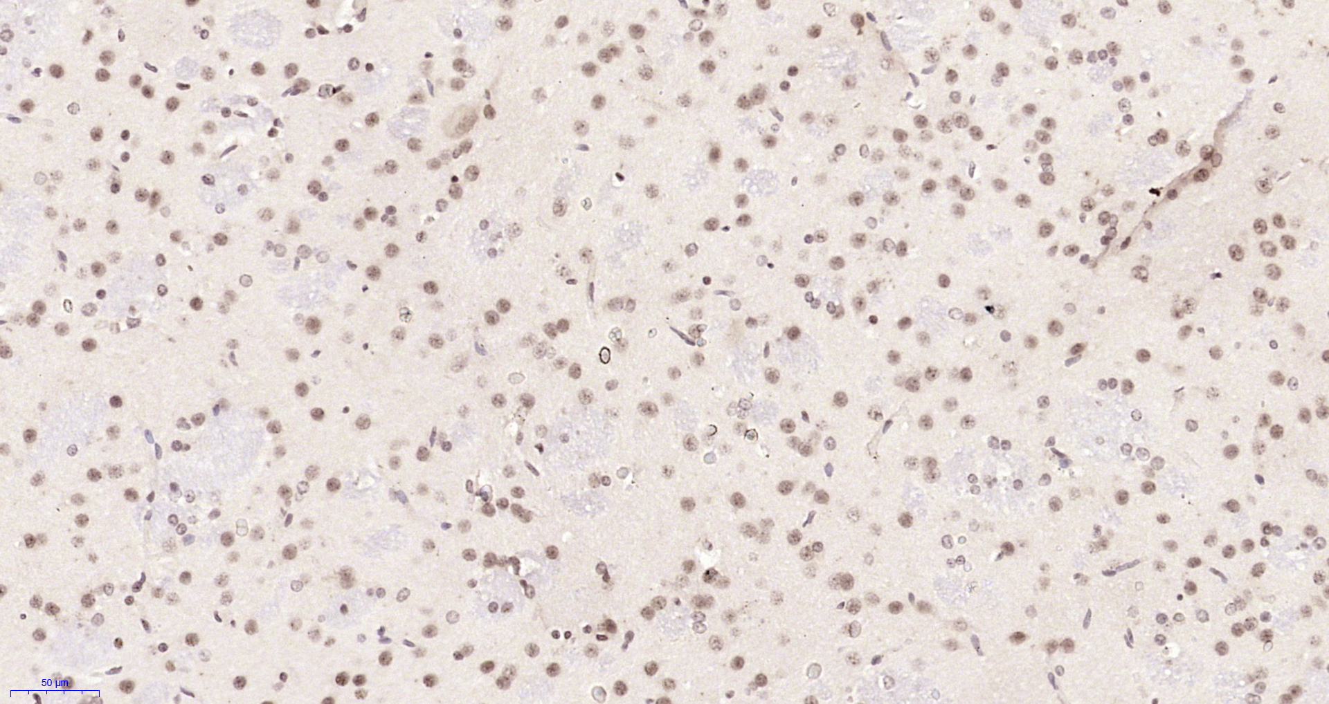 Paraformaldehyde-fixed, paraffin embedded Rat brain; Antigen retrieval by boiling in sodium citrate buffer (pH6.0) for 15min; Block endogenous peroxidase by 3% hydrogen peroxide for 20 minutes; Blocking buffer (normal goat serum) at 37°C for 30min; Antibody incubation with Neuro D4/DPF1 Polyclonal Antibody, Unconjugated (bs-11573R) at 1:200 overnight at 4°C, DAB staining.