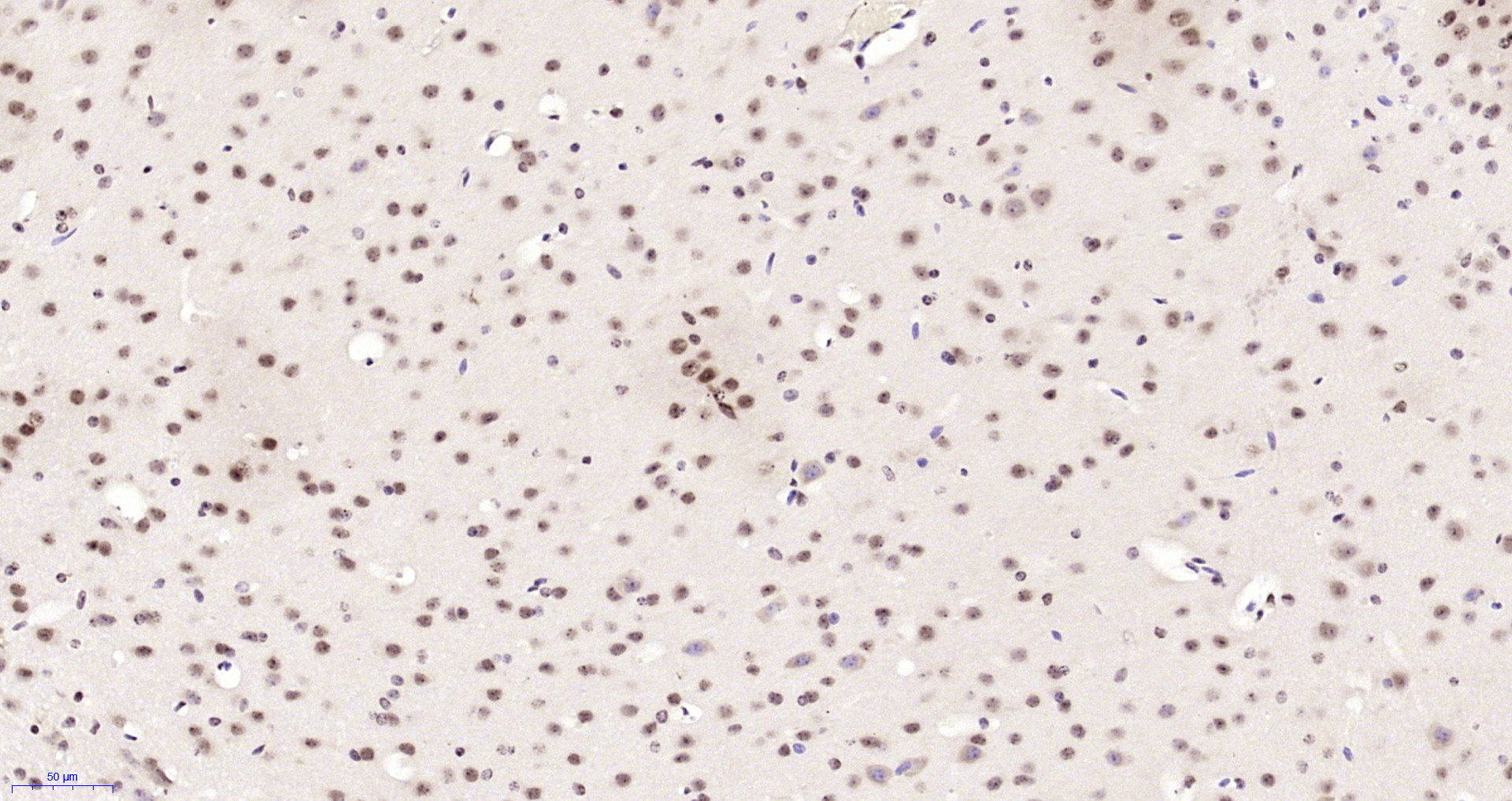 Paraformaldehyde-fixed, paraffin embedded Mouse brain; Antigen retrieval by boiling in sodium citrate buffer (pH6.0) for 15min; Block endogenous peroxidase by 3% hydrogen peroxide for 20 minutes; Blocking buffer (normal goat serum) at 37°C for 30min; Antibody incubation with Neuro D4/DPF1 Polyclonal Antibody, Unconjugated (bs-11573R) at 1:200 overnight at 4°C, DAB staining.