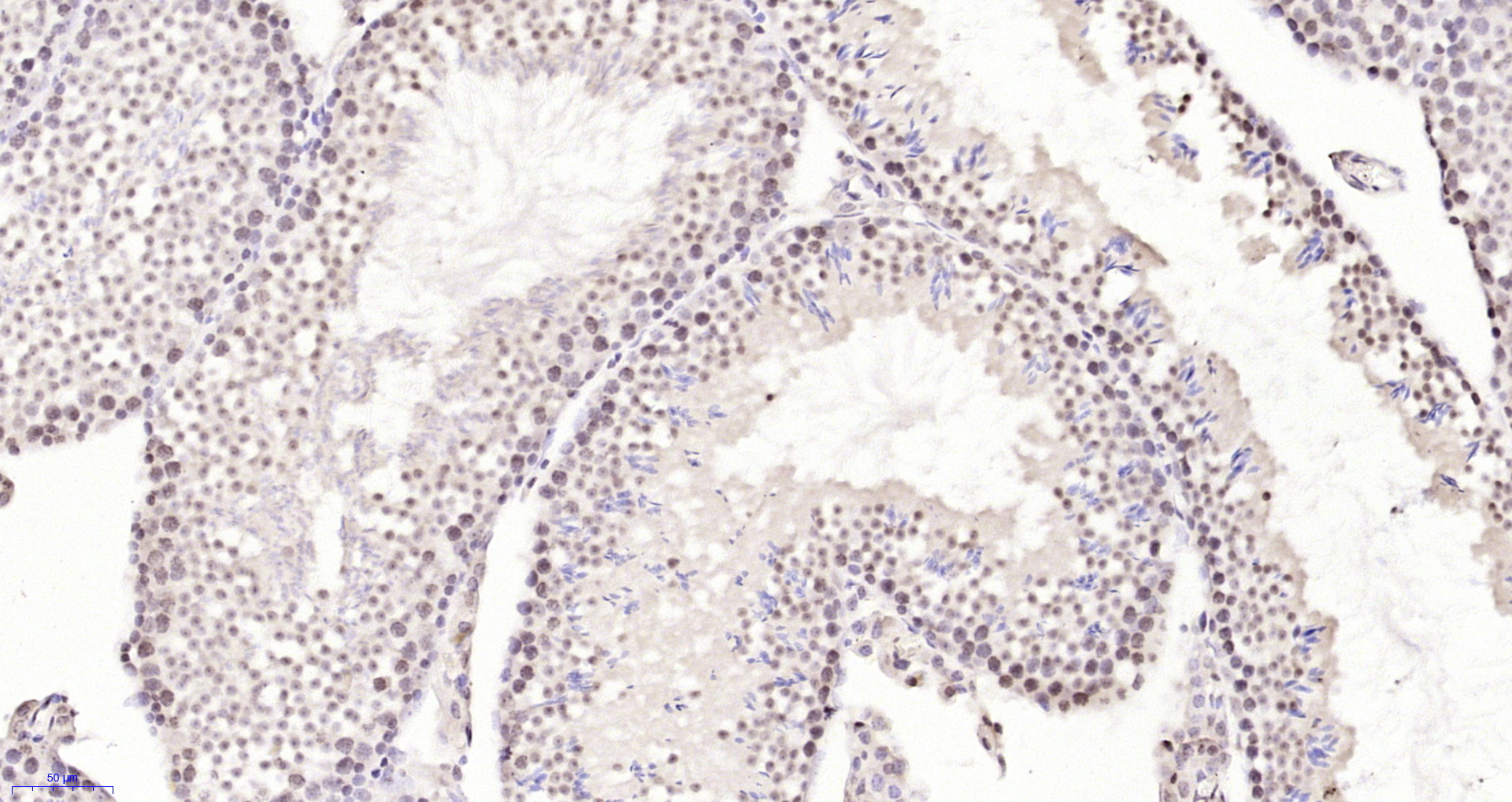 Paraformaldehyde-fixed, paraffin embedded Mouse testis; Antigen retrieval by boiling in sodium citrate buffer (pH6.0) for 15min; Block endogenous peroxidase by 3% hydrogen peroxide for 20 minutes; Blocking buffer (normal goat serum) at 37°C for 30min; Antibody incubation with Neuro D4/DPF1 Polyclonal Antibody, Unconjugated (bs-11573R) at 1:200 overnight at 4°C, DAB staining.