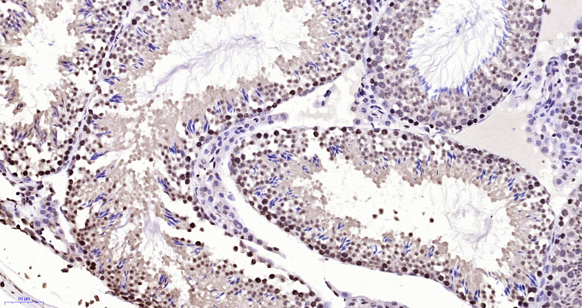 Paraformaldehyde-fixed, paraffin embedded Mouse testis; Antigen retrieval by boiling in sodium citrate buffer (pH6.0) for 15min; Block endogenous peroxidase by 3% hydrogen peroxide for 20 minutes; Blocking buffer (normal goat serum) at 37°C for 30min; Antibody incubation with BPTF/FALZ Polyclonal Antibody, Unconjugated (bs-11641R) at 1:200 overnight at 4°C, DAB staining.