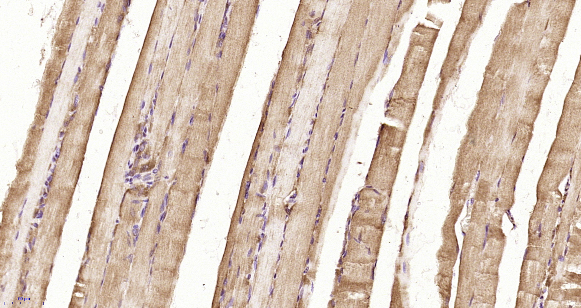 Paraformaldehyde-fixed, paraffin embedded Rat muscle ; Antigen retrieval by boiling in sodium citrate buffer (pH6.0) for 15min; Block endogenous peroxidase by 3% hydrogen peroxide for 20 minutes; Blocking buffer (normal goat serum) at 37°C for 30min; Antibody incubation with UCHL3 Polyclonal Antibody, Unconjugated (bs-11676R) at 1:200 overnight at 4°C, DAB staining.