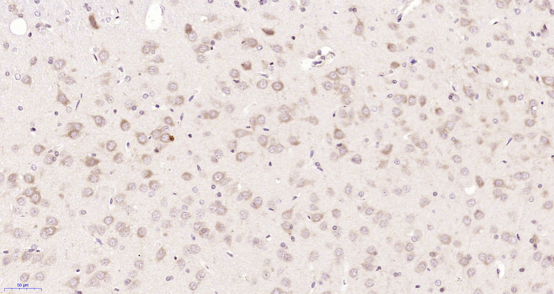 Paraformaldehyde-fixed, paraffin embedded Rat brain ; Antigen retrieval by boiling in sodium citrate buffer (pH6.0) for 15min; Block endogenous peroxidase by 3% hydrogen peroxide for 20 minutes; Blocking buffer (normal goat serum) at 37°C for 30min; Antibody incubation with SPG3A/Atlastin Polyclonal Antibody, Unconjugated (bs-11759R) at 1:200 overnight at 4°C, DAB staining.