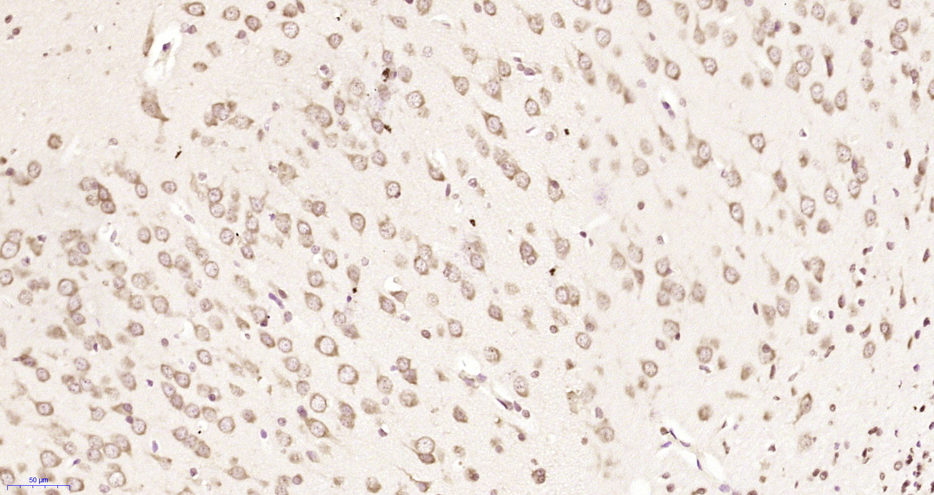 Paraformaldehyde-fixed, paraffin embedded Rat brain ; Antigen retrieval by boiling in sodium citrate buffer (pH6.0) for 15min; Block endogenous peroxidase by 3% hydrogen peroxide for 20 minutes; Blocking buffer (normal goat serum) at 37°C for 30min; Antibody incubation with CSAD Polyclonal Antibody, Unconjugated (bs-11822R) at 1:200 overnight at 4°C, DAB staining.