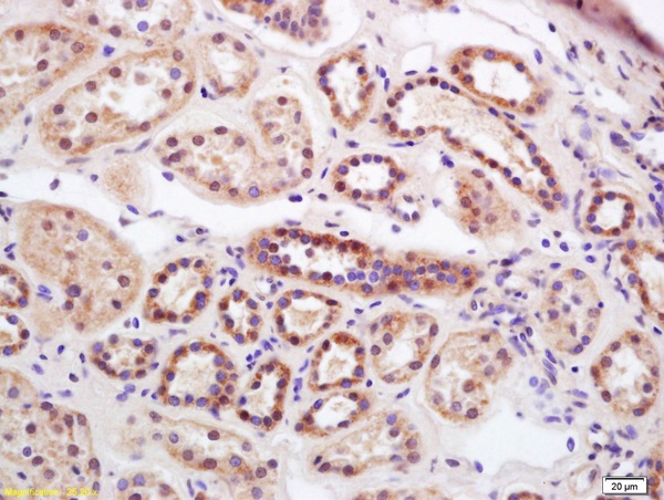 Formalin-fixed and paraffin embedded human kidney labeled with Rabbit Anti RISC/Serine carboxypeptidase 1 Polyclonal Antibody, Unconjugated (bs-7542R) at 1:200 followed by conjugation to the secondary antibody and DAB staining Formalin-fixed and paraffin embedded human kidney labeled with Rabbit Anti RISC/Serine carboxypeptidase 1 Polyclonal Antibody, Unconjugated (bs-7542R) at 1:200 followed by conjugation to the secondary antibody and DAB staining