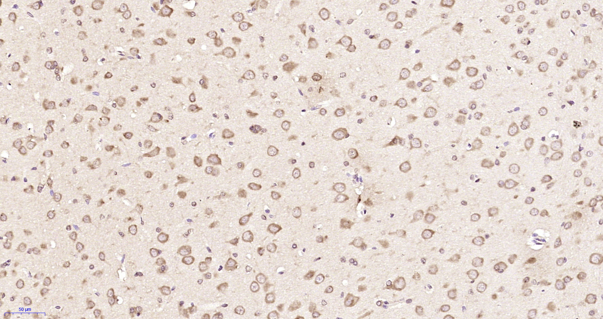 Paraformaldehyde-fixed, paraffin embedded Rat brain ; Antigen retrieval by boiling in sodium citrate buffer (pH6.0) for 15min; Block endogenous peroxidase by 3% hydrogen peroxide for 20 minutes; Blocking buffer (normal goat serum) at 37°C for 30min; Antibody incubation with UCHL3 Polyclonal Antibody, Unconjugated (bs-11845R) at 1:200 overnight at 4°C, DAB staining.