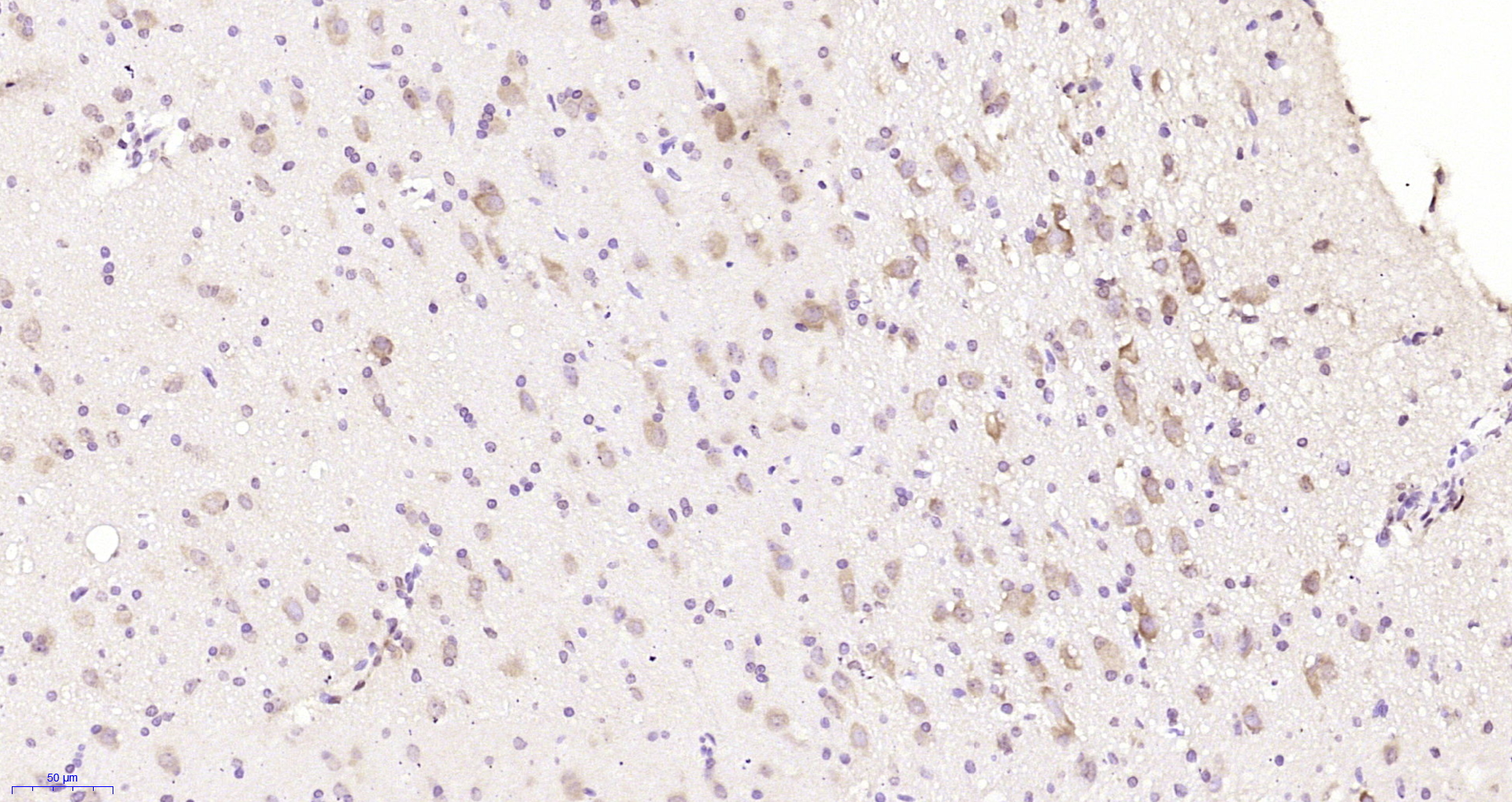 Paraformaldehyde-fixed, paraffin embedded Rat brain; Antigen retrieval by boiling in sodium citrate buffer (pH6.0) for 15min; Block endogenous peroxidase by 3% hydrogen peroxide for 20 minutes; Blocking buffer (normal goat serum) at 37°C for 30min; Antibody incubation with CHIP Polyclonal Antibody, Unconjugated (bs-15405R) at 1:200 overnight at 4°C, DAB staining.