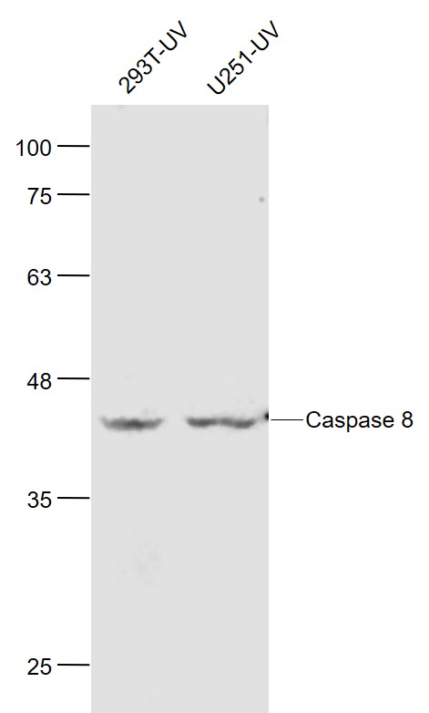 Lane 1: 293T-UV cell lysates; Lane 2: U251-UV cell lysates probed with Caspase 8 Monoclonal Antibody, Unconjugated (bsm-33190M) at 1:4000 dilution and 4˚C overnight incubation. Followed by conjugated secondary antibody incubation at 1:20000 for 60 min at 37˚C.