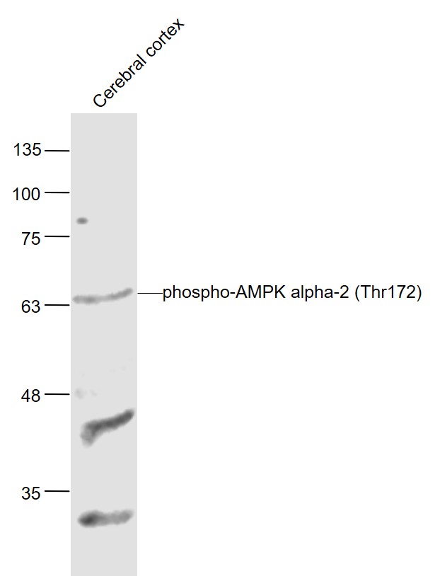 Lane 1: Mouse Cerebral cortex lysates probed with AMPK alpha-1/2 (Thr183/Thr172) Polyclonal Antibody, Unconjugated (bs-4002R) at 1:1000 dilution and 4˚C overnight incubation. Followed by conjugated secondary antibody incubation at 1:20000 for 60 min at 37˚C.
