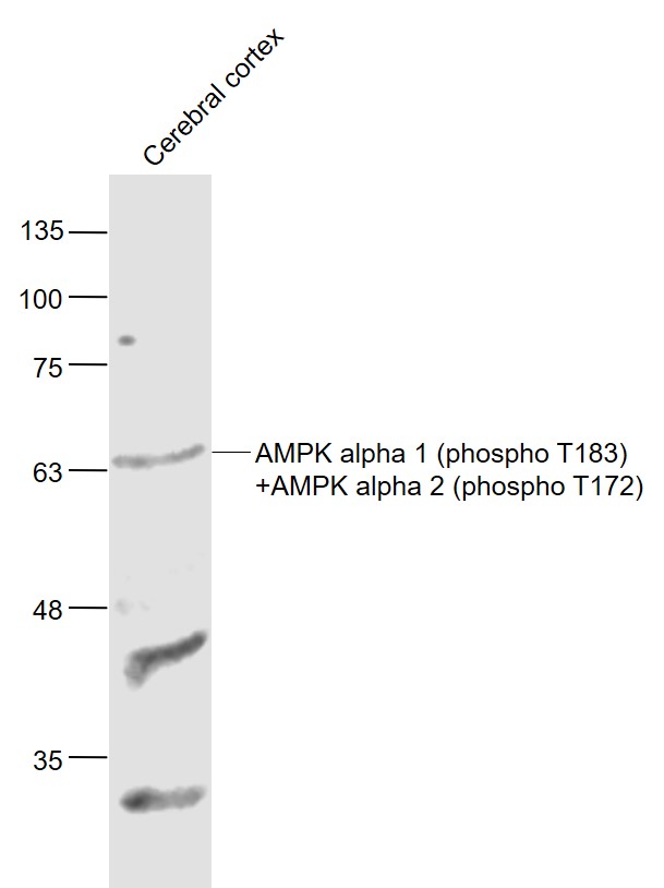 Lane 1: Mouse Cerebral cortex lysates probed with AMPK alpha 1 (phospho T183) + AMPK alpha 2 (phospho T172) Polyclonal Antibody, Unconjugated (bs-8813R) at 1:1000 dilution and 4˚C overnight incubation. Followed by conjugated secondary antibody incubation at 1:20000 for 60 min at 37˚C.