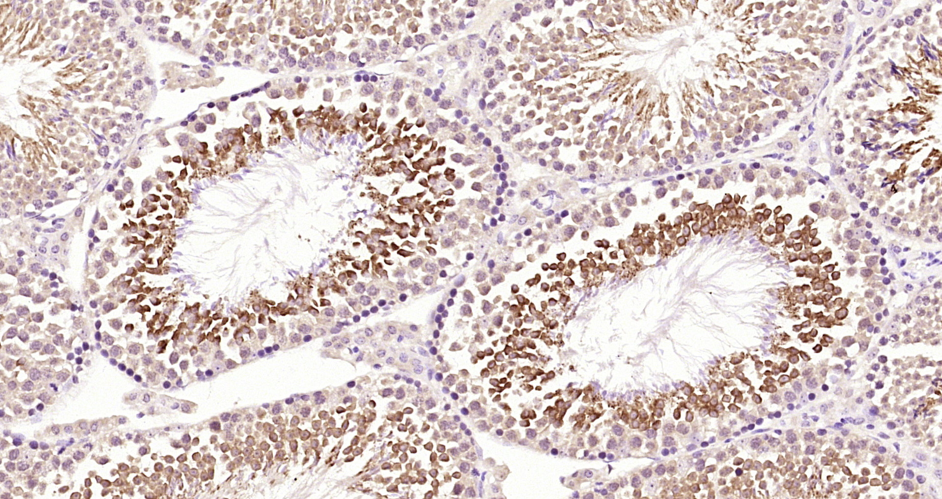 Paraformaldehyde-fixed, paraffin embedded Mouse testis; Antigen retrieval by boiling in sodium citrate buffer (pH6.0) for 15min; Block endogenous peroxidase by 3% hydrogen peroxide for 20 minutes; Blocking buffer (normal goat serum) at 37°C for 30min; Antibody incubation with MEK5 Polyclonal Antibody, Unconjugated (bs-4124R) at 1:200 overnight at 4°C, DAB staining.