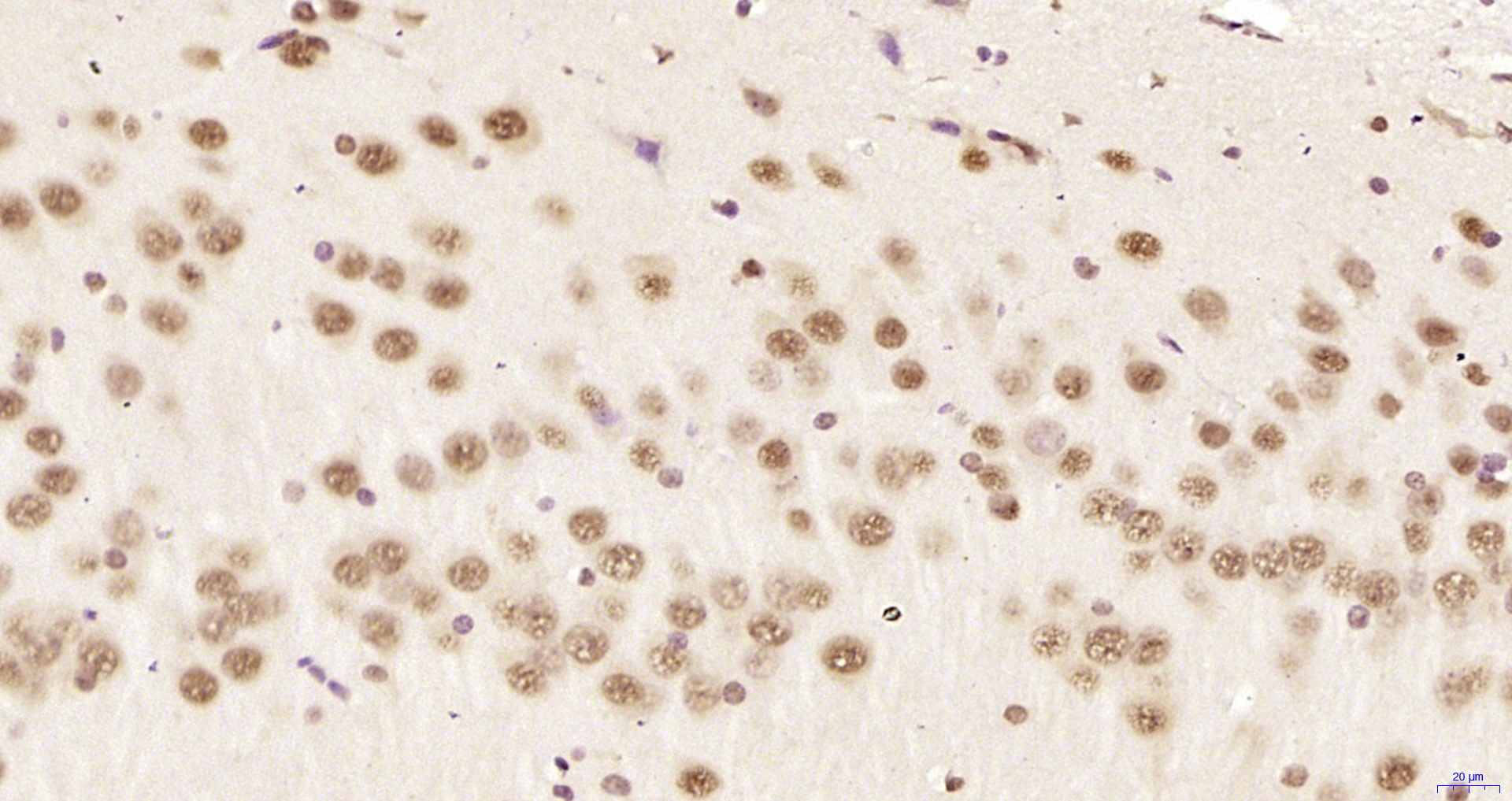 Paraformaldehyde-fixed, paraffin embedded Rat brain; Antigen retrieval by boiling in sodium citrate buffer (pH6.0) for 15min; Block endogenous peroxidase by 3% hydrogen peroxide for 20 minutes; Blocking buffer (normal goat serum) at 37°C for 30min; Antibody incubation with hnRNP K Polyclonal Antibody, Unconjugated (bs-4296R) at 1:200 overnight at 4°C, DAB staining.