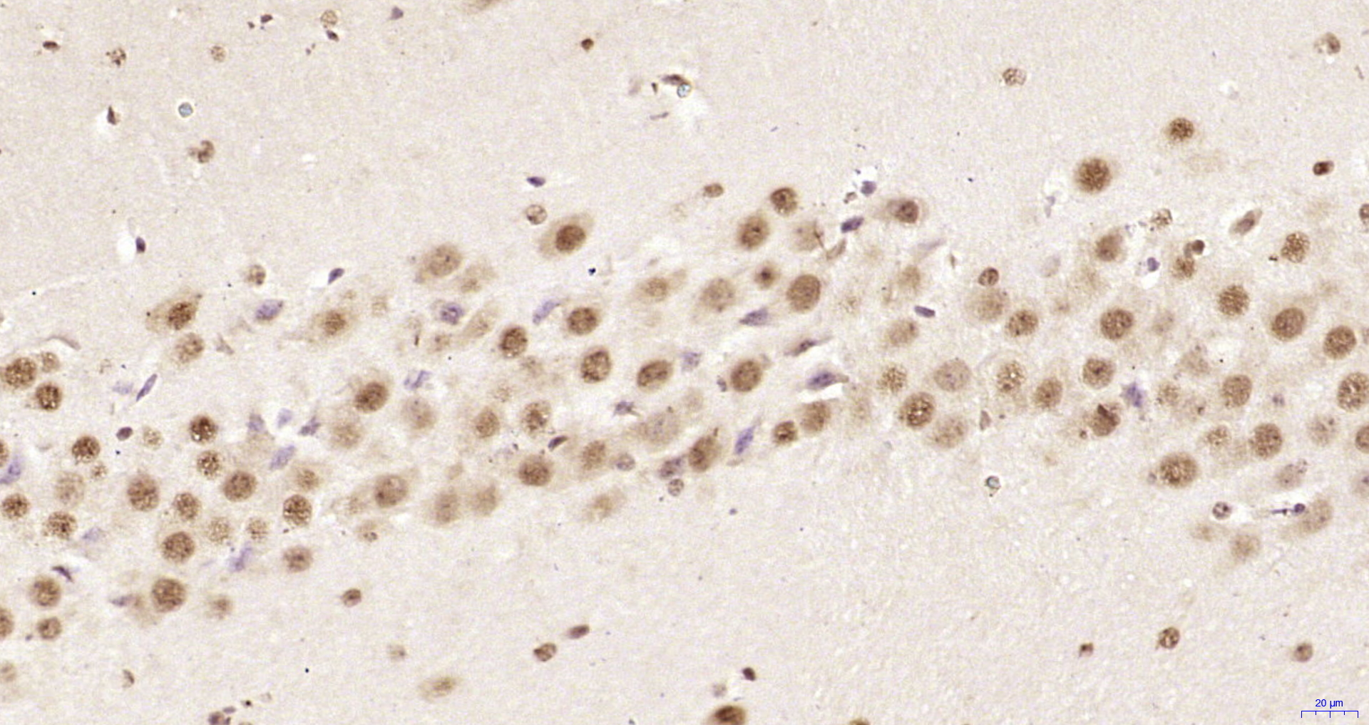 Paraformaldehyde-fixed, paraffin embedded Mouse brain; Antigen retrieval by boiling in sodium citrate buffer (pH6.0) for 15min; Block endogenous peroxidase by 3% hydrogen peroxide for 20 minutes; Blocking buffer (normal goat serum) at 37°C for 30min; Antibody incubation with hnRNP K Polyclonal Antibody, Unconjugated (bs-4296R) at 1:200 overnight at 4°C, DAB staining.