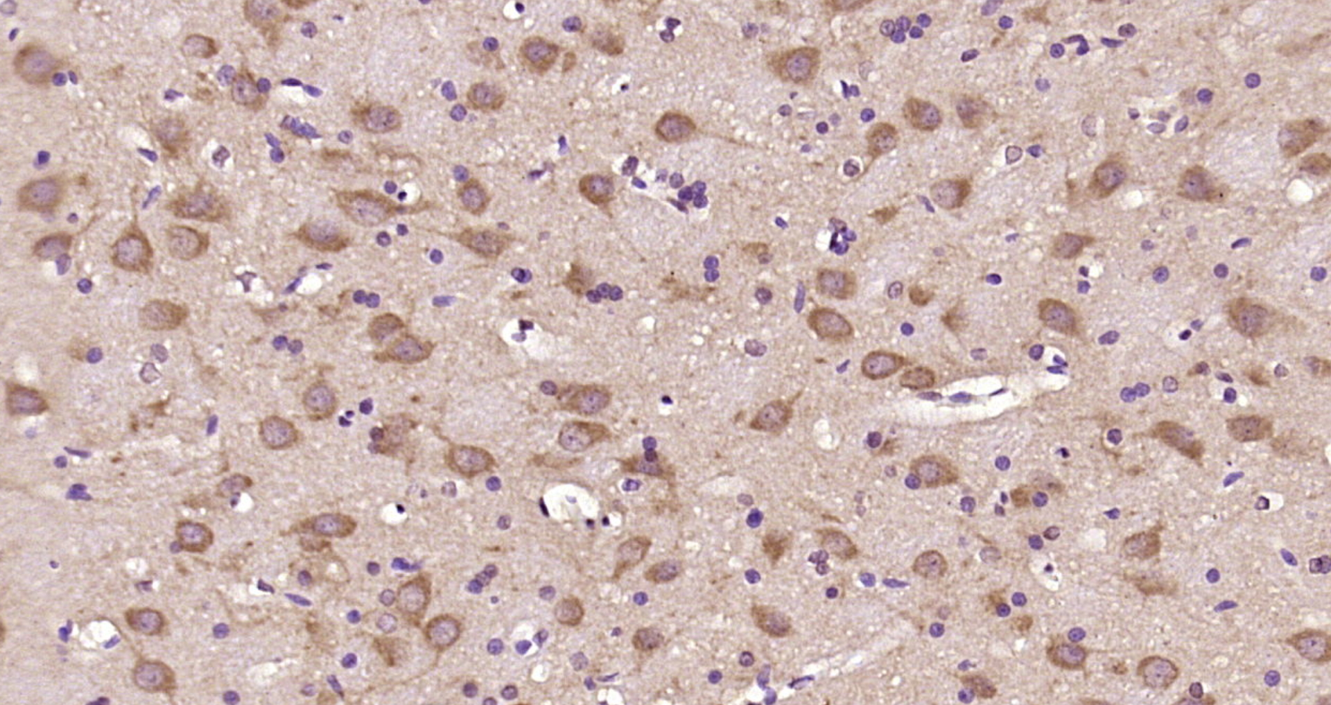 Paraformaldehyde-fixed, paraffin embedded Rat brain; Antigen retrieval by boiling in sodium citrate buffer (pH6.0) for 15min; Block endogenous peroxidase by 3% hydrogen peroxide for 20 minutes; Blocking buffer (normal goat serum) at 37°C for 30min; Antibody incubation with tubulin Beta Polyclonal Antibody, Unconjugated (bs-4511R) at 1:200 overnight at 4°C, DAB staining.