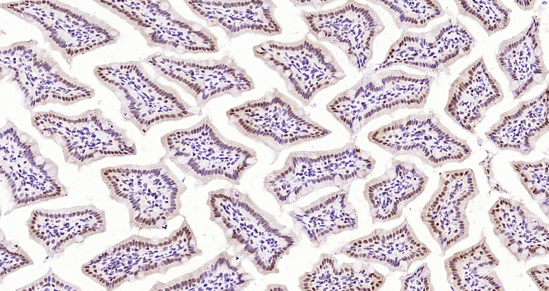 Paraformaldehyde-fixed, paraffin embedded Mouse intestine; Antigen retrieval by boiling in sodium citrate buffer (pH6.0) for 15min; Block endogenous peroxidase by 3% hydrogen peroxide for 20 minutes; Blocking buffer (normal goat serum) at 37°C for 30min; Antibody incubation with Elongin B Polyclonal Antibody, Unconjugated (bs-5136R) at 1:200 overnight at 4°C, DAB staining.