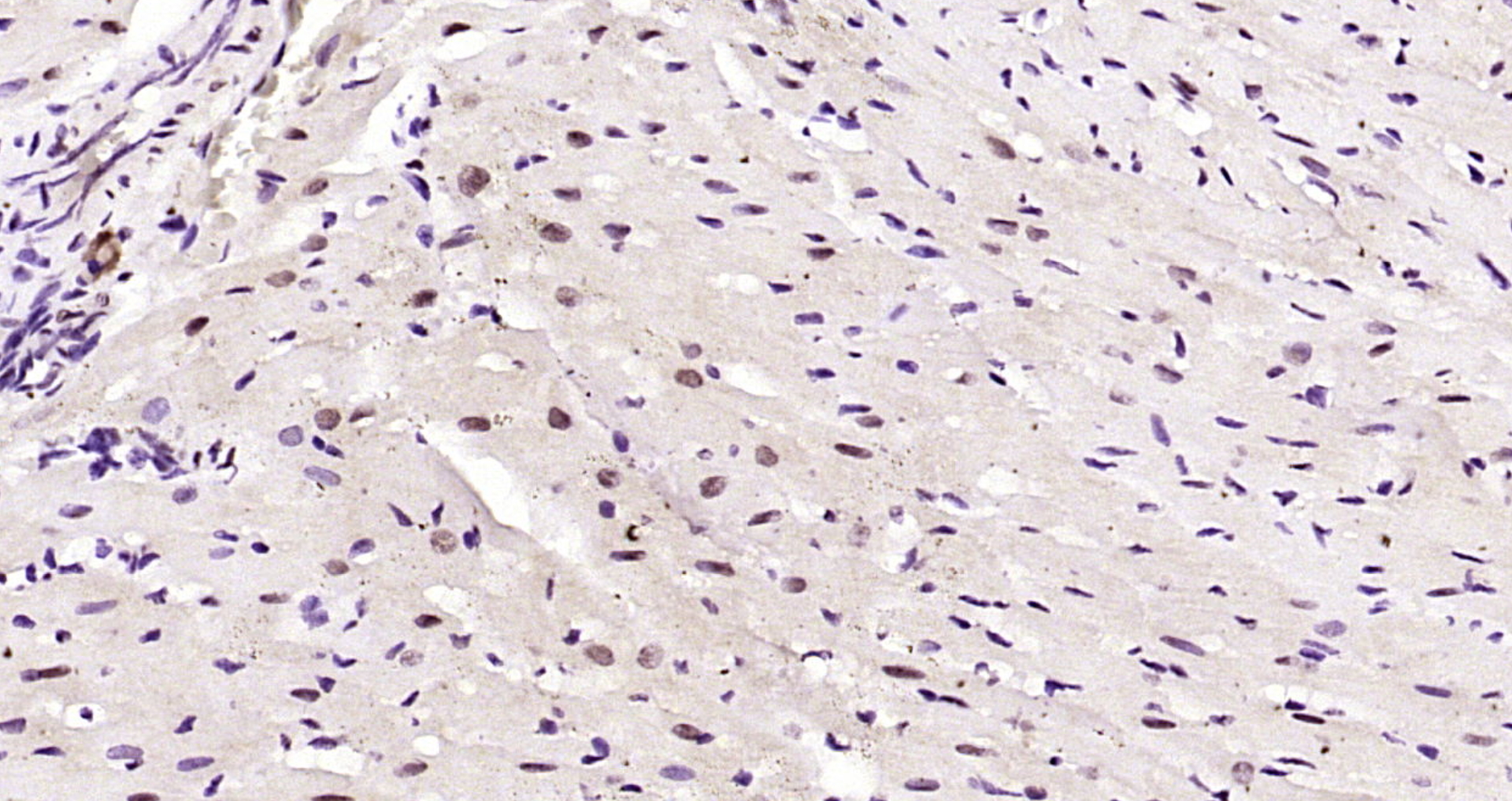 AMPK alpha 1 Thr198 Antibody Bioss