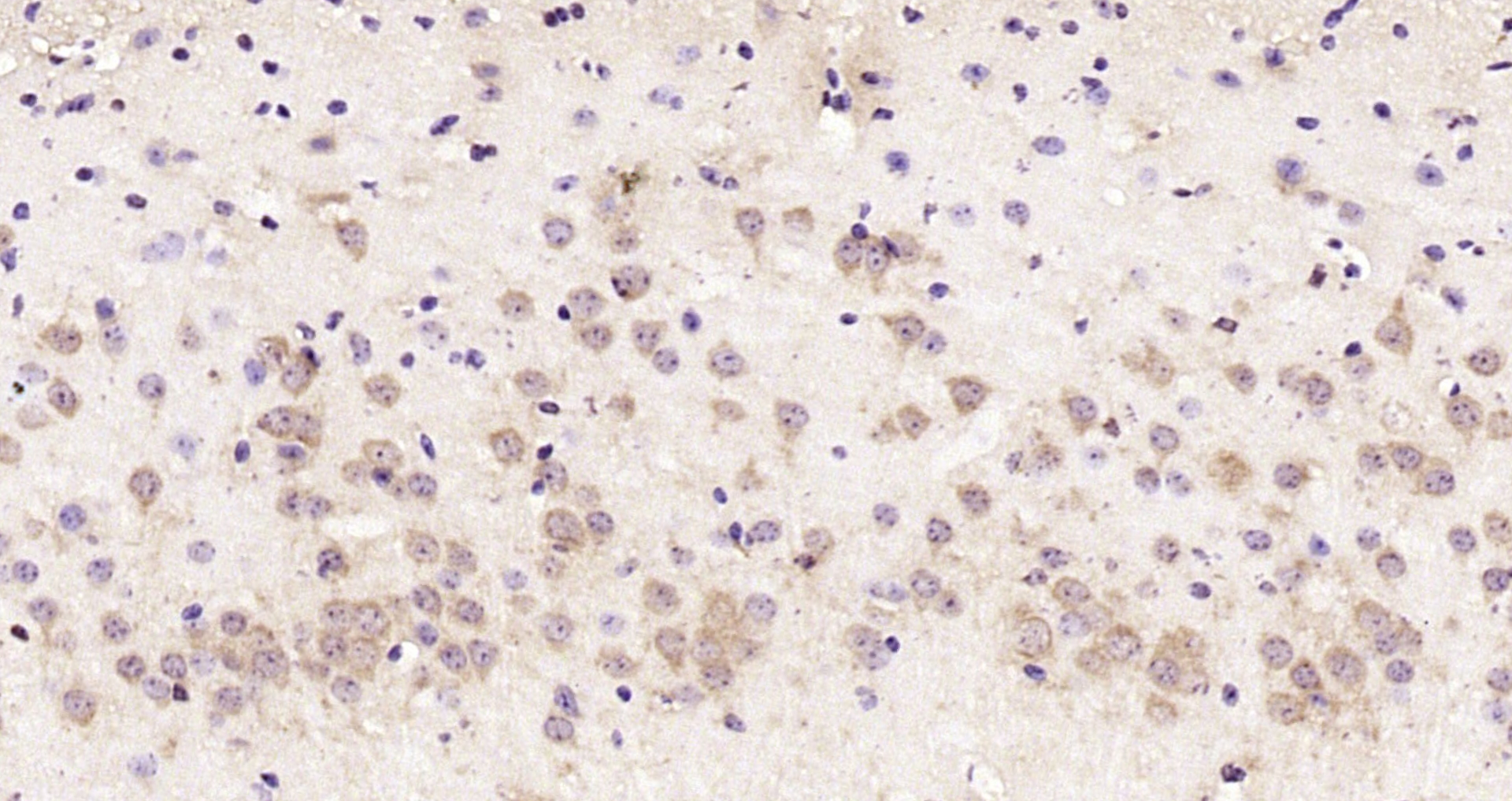 Paraformaldehyde-fixed, paraffin embedded Mouse brain; Antigen retrieval by boiling in sodium citrate buffer (pH6.0) for 15min; Block endogenous peroxidase by 3% hydrogen peroxide for 20 minutes; Blocking buffer (normal goat serum) at 37°C for 30min; Antibody incubation with RSRC2 Polyclonal Antibody, Unconjugated (bs-6097R) at 1:200 overnight at 4°C, DAB staining.