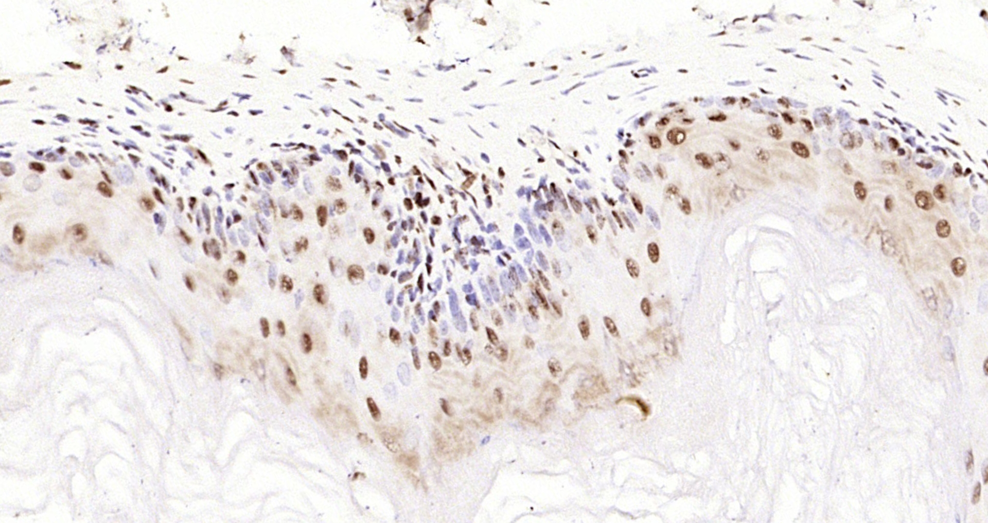 Paraformaldehyde-fixed, paraffin embedded Mouse stomach; Antigen retrieval by boiling in sodium citrate buffer (pH6.0) for 15min; Block endogenous peroxidase by 3% hydrogen peroxide for 20 minutes; Blocking buffer (normal goat serum) at 37°C for 30min; Antibody incubation with UGDH Polyclonal Antibody, Unconjugated (bs-6715R) at 1:200 overnight at 4°C, DAB staining.