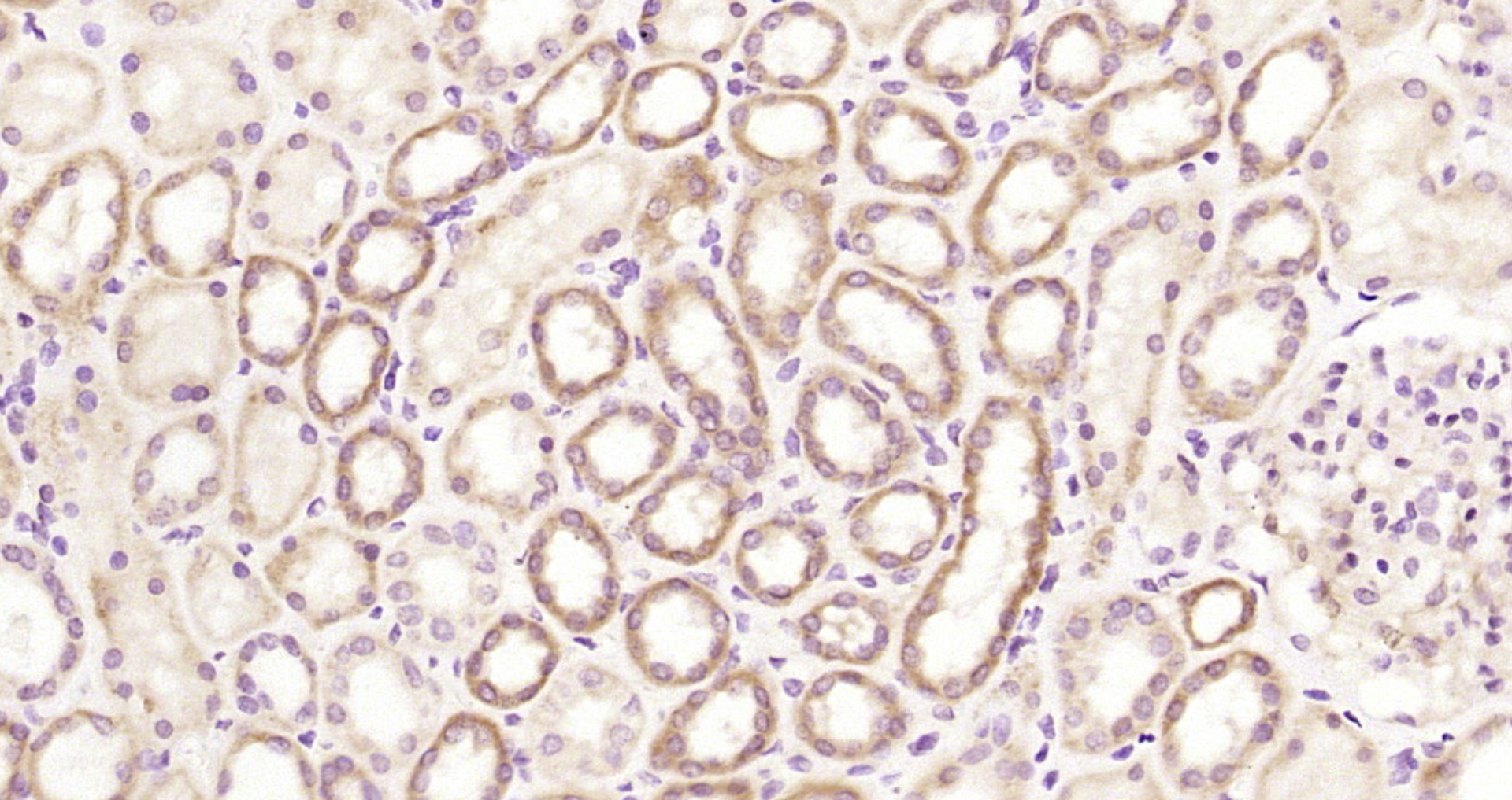 Paraformaldehyde-fixed, paraffin embedded Human kidney; Antigen retrieval by boiling in sodium citrate buffer (pH6.0) for 15min; Block endogenous peroxidase by 3% hydrogen peroxide for 20 minutes; Blocking buffer (normal goat serum) at 37°C for 30min; Antibody incubation with A2LD1/GGACT Polyclonal Antibody, Unconjugated (bs-11381R) at 1:200 overnight at 4°C, DAB staining.