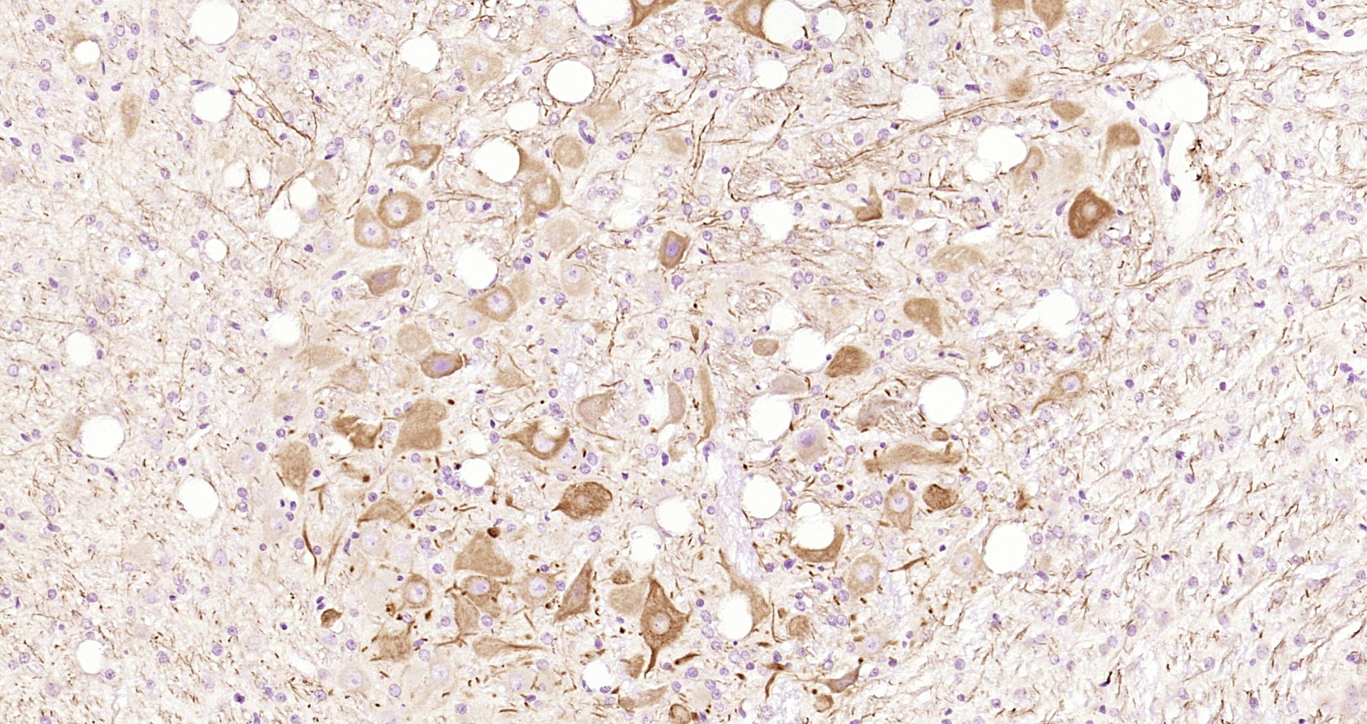 Paraformaldehyde-fixed, paraffin embedded Rat brain; Antigen retrieval by boiling in sodium citrate buffer (pH6.0) for 15min; Block endogenous peroxidase by 3% hydrogen peroxide for 20 minutes; Blocking buffer (normal goat serum) at 37°C for 30min; Antibody incubation with Calcipressin 3 Polyclonal Antibody, Unconjugated (bs-11542R) at 1:200 overnight at 4°C, DAB staining.