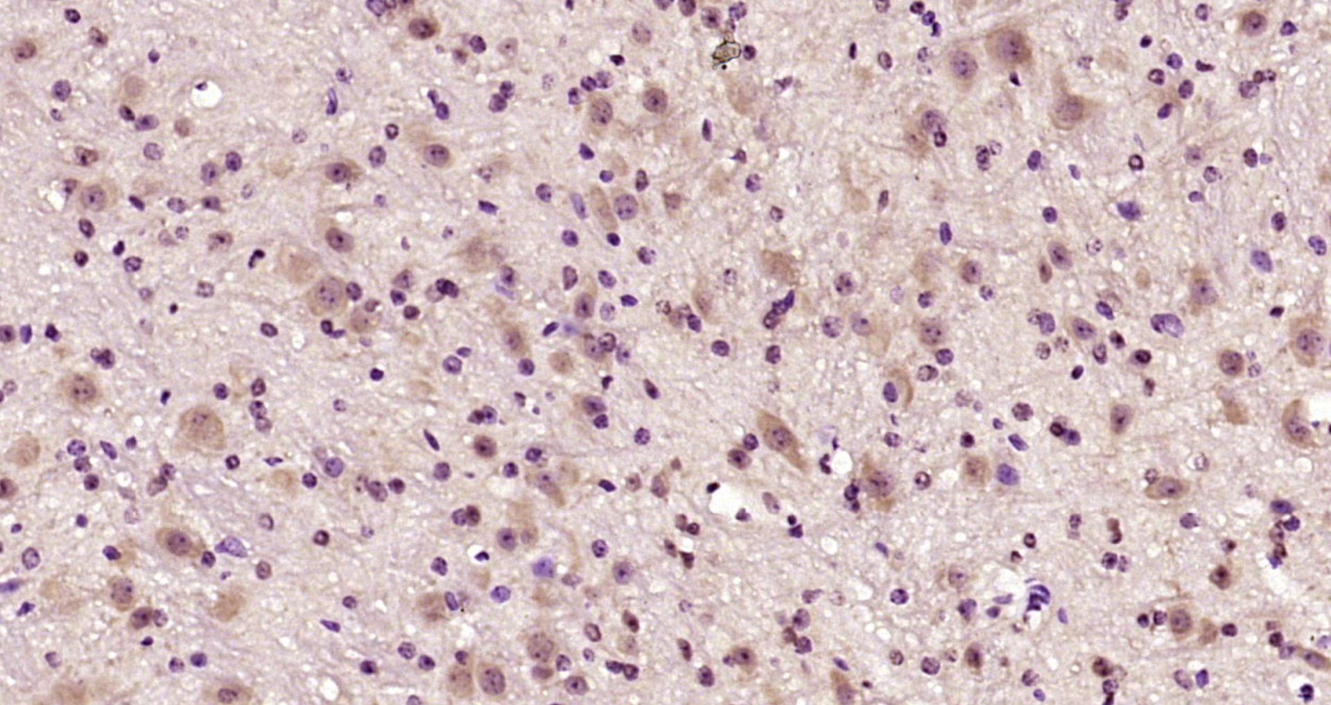 Paraformaldehyde-fixed, paraffin embedded Mouse cerebellum; Antigen retrieval by boiling in sodium citrate buffer (pH6.0) for 15min; Block endogenous peroxidase by 3% hydrogen peroxide for 20 minutes; Blocking buffer (normal goat serum) at 37°C for 30min; Antibody incubation with Ataxin 1 (Ser775) Polyclonal Antibody, Unconjugated (bs-12534R) at 1:200 overnight at 4°C, DAB staining.