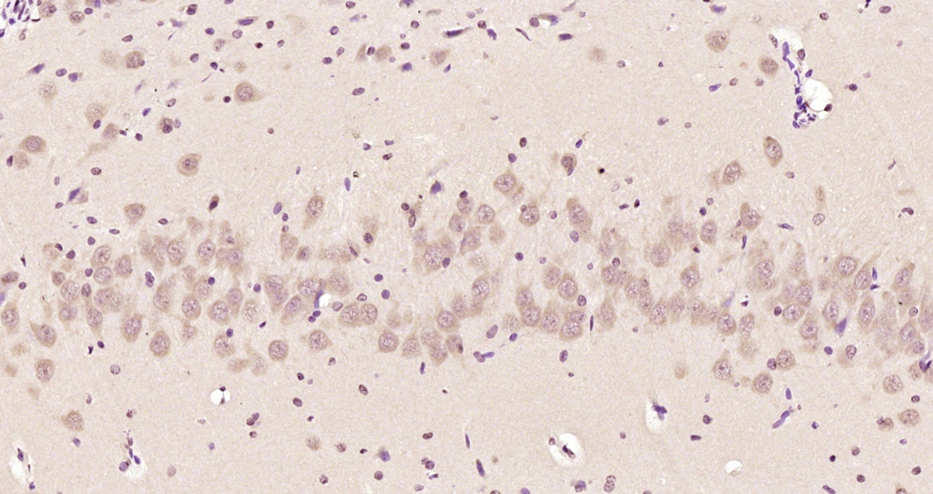 Paraformaldehyde-fixed, paraffin embedded Rat brain; Antigen retrieval by boiling in sodium citrate buffer (pH6.0) for 15min; Block endogenous peroxidase by 3% hydrogen peroxide for 20 minutes; Blocking buffer (normal goat serum) at 37°C for 30min; Antibody incubation with Ataxin 1 (Ser775) Polyclonal Antibody, Unconjugated (bs-12534R) at 1:200 overnight at 4°C, DAB staining.