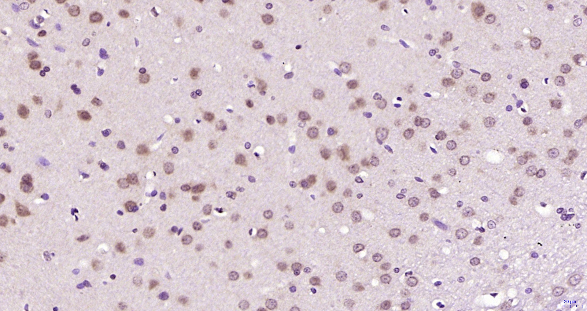 Paraformaldehyde-fixed, paraffin embedded Rat brain; Antigen retrieval by boiling in sodium citrate buffer (pH6.0) for 15min; Block endogenous peroxidase by 3% hydrogen peroxide for 20 minutes; Blocking buffer (normal goat serum) at 37°C for 30min; Antibody incubation with GNL3L Polyclonal Antibody, Unconjugated (bs-13472R) at 1:200 overnight at 4°C, DAB staining.