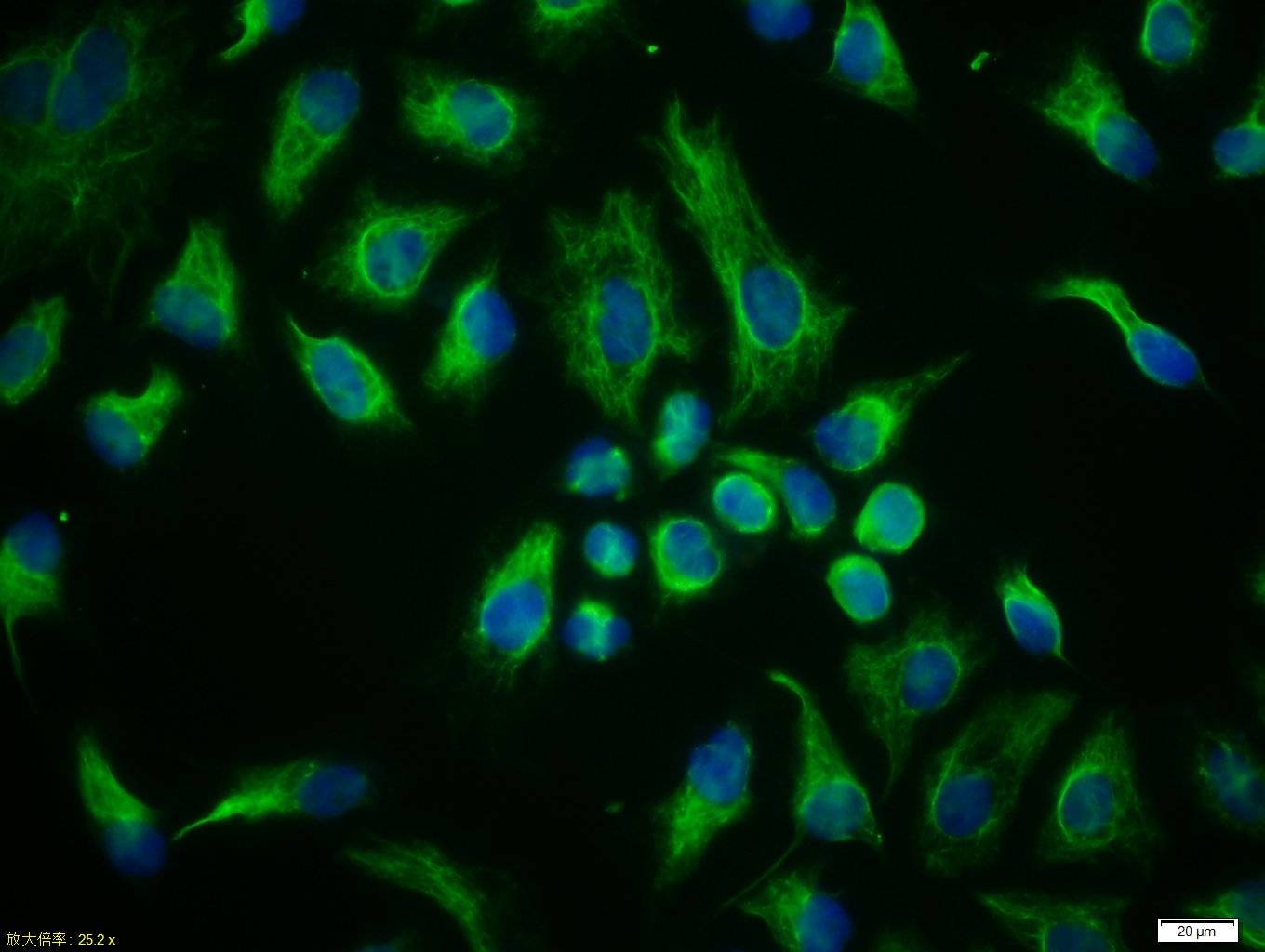 HeLa cells were stained with Vimentin Polyclonal Antibody, Unconjugated(bs-0756R) at 1:50 in PBS and incubated for two hours at 37\u00b0C followed by Goat Anti-Rabbit IgG (H+L) FITC conjugated secondary antibody. DAPI staining of the nucleus was done and then detected. 