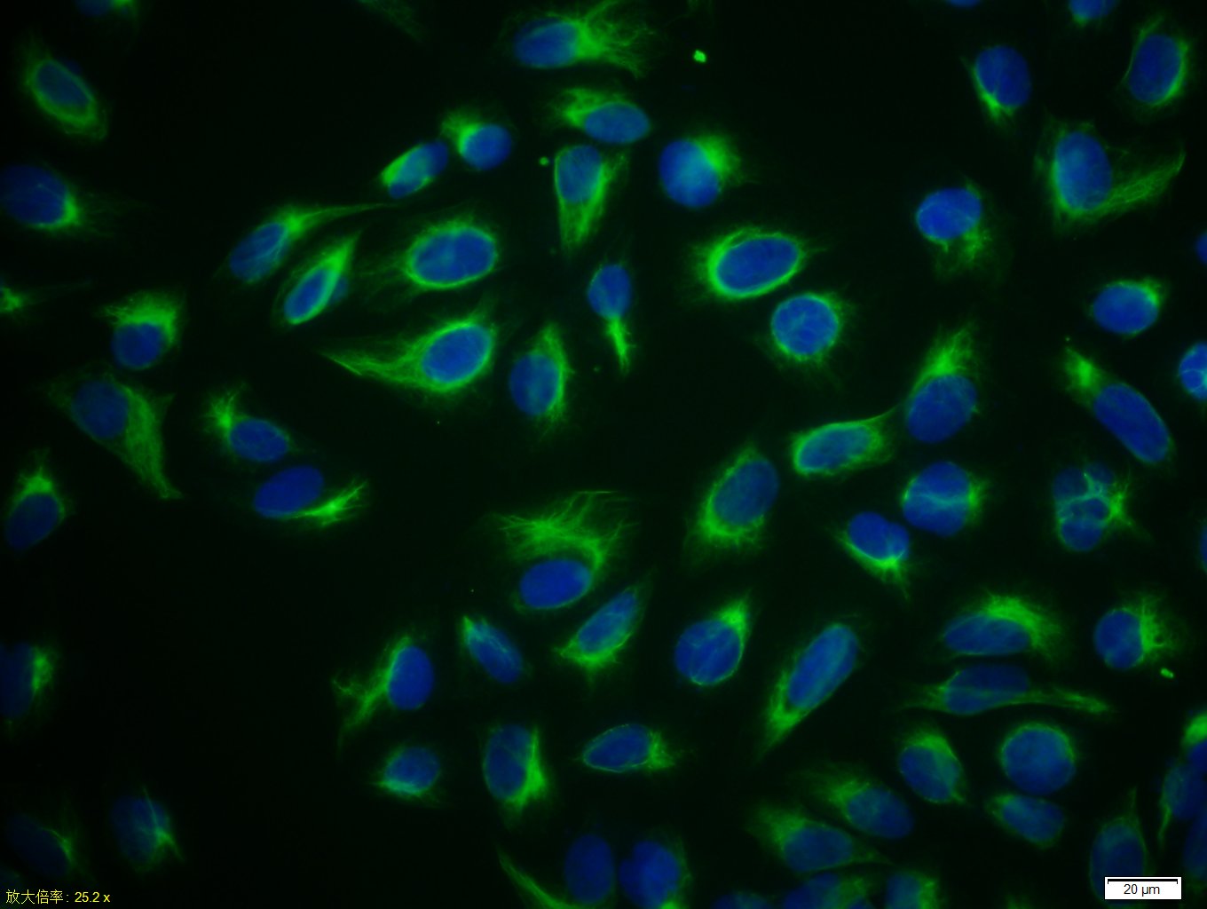 U-2 OS cells were stained with Vimentin Polyclonal Antibody, Unconjugated(bs-0756R) at 1:50 in PBS and incubated for two hours at 37°C followed by Goat Anti-Rabbit IgG (H+L) FITC conjugated secondary antibody. DAPI staining of the nucleus was done and then detected.