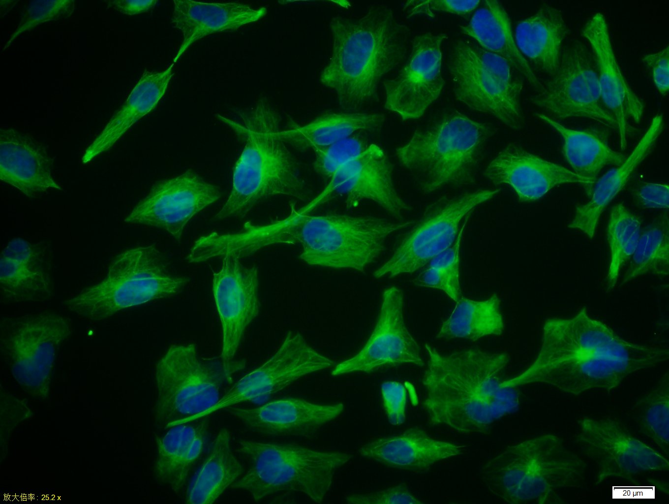 U251 cells were stained with Vimentin Polyclonal Antibody, Unconjugated(bs-0756R) at 1:50 in PBS and incubated for two hours at 37°C followed by Goat Anti-Rabbit IgG (H+L) FITC conjugated secondary antibody. DAPI staining of the nucleus was done and then detected.